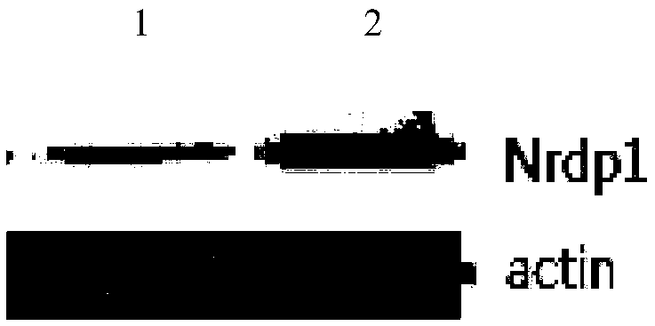 Immunoliposome based on Nrdp1 gene RNAi and miR-494 and application thereof