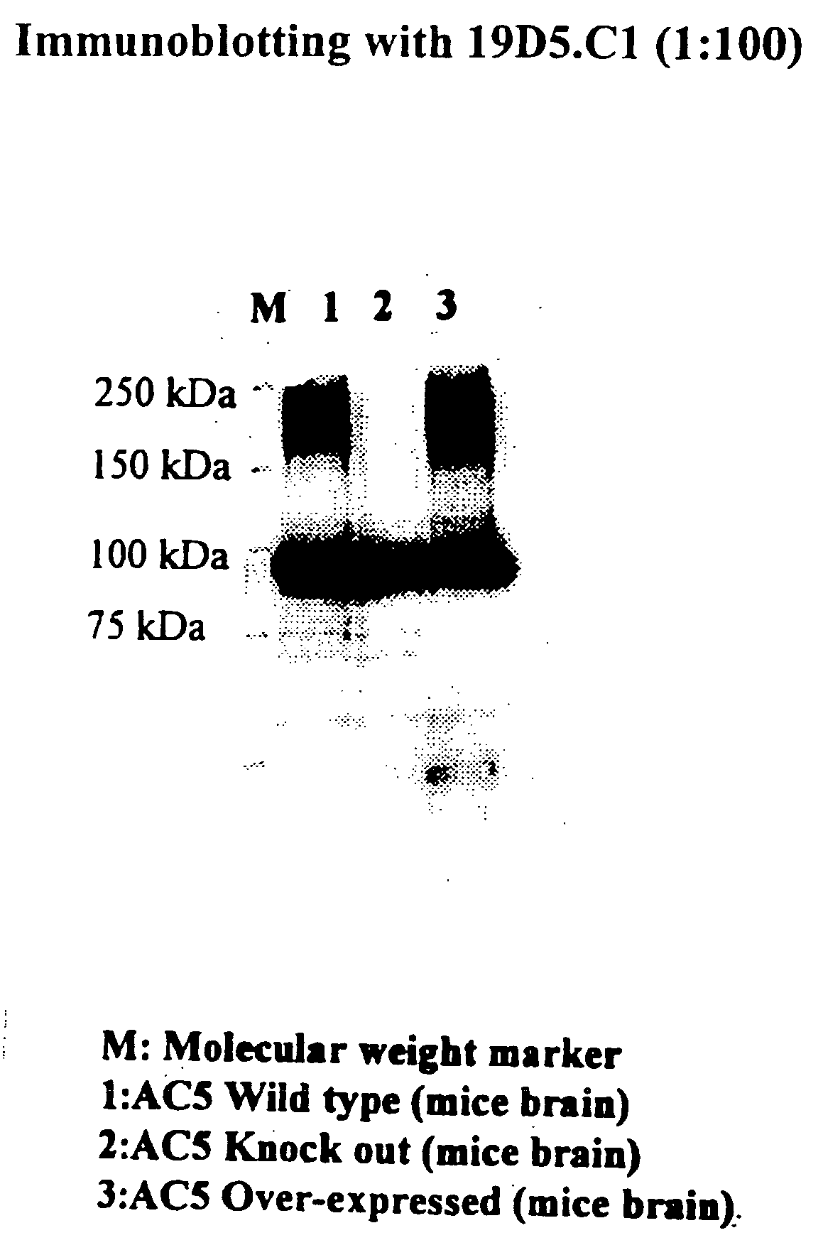 Adenylyl Cyclase Antibodies, Compositions and Uses Thereof