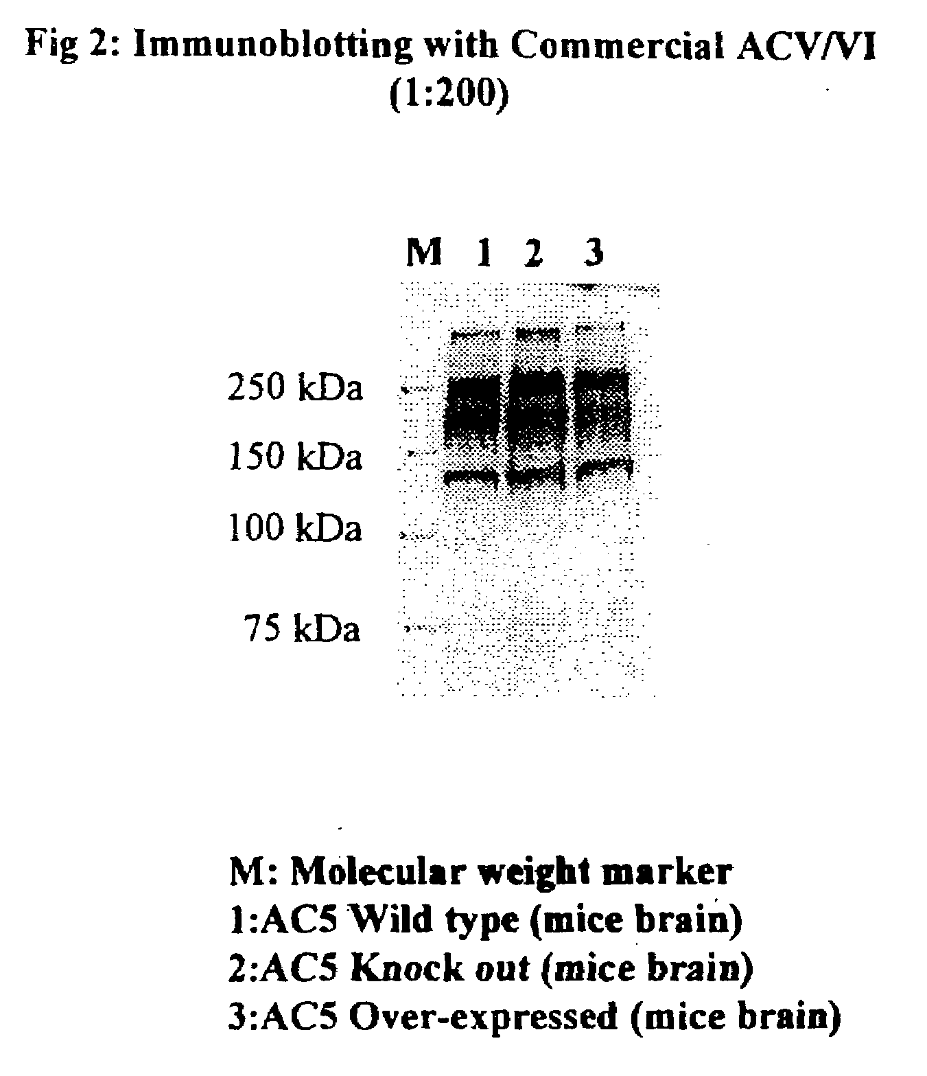 Adenylyl Cyclase Antibodies, Compositions and Uses Thereof