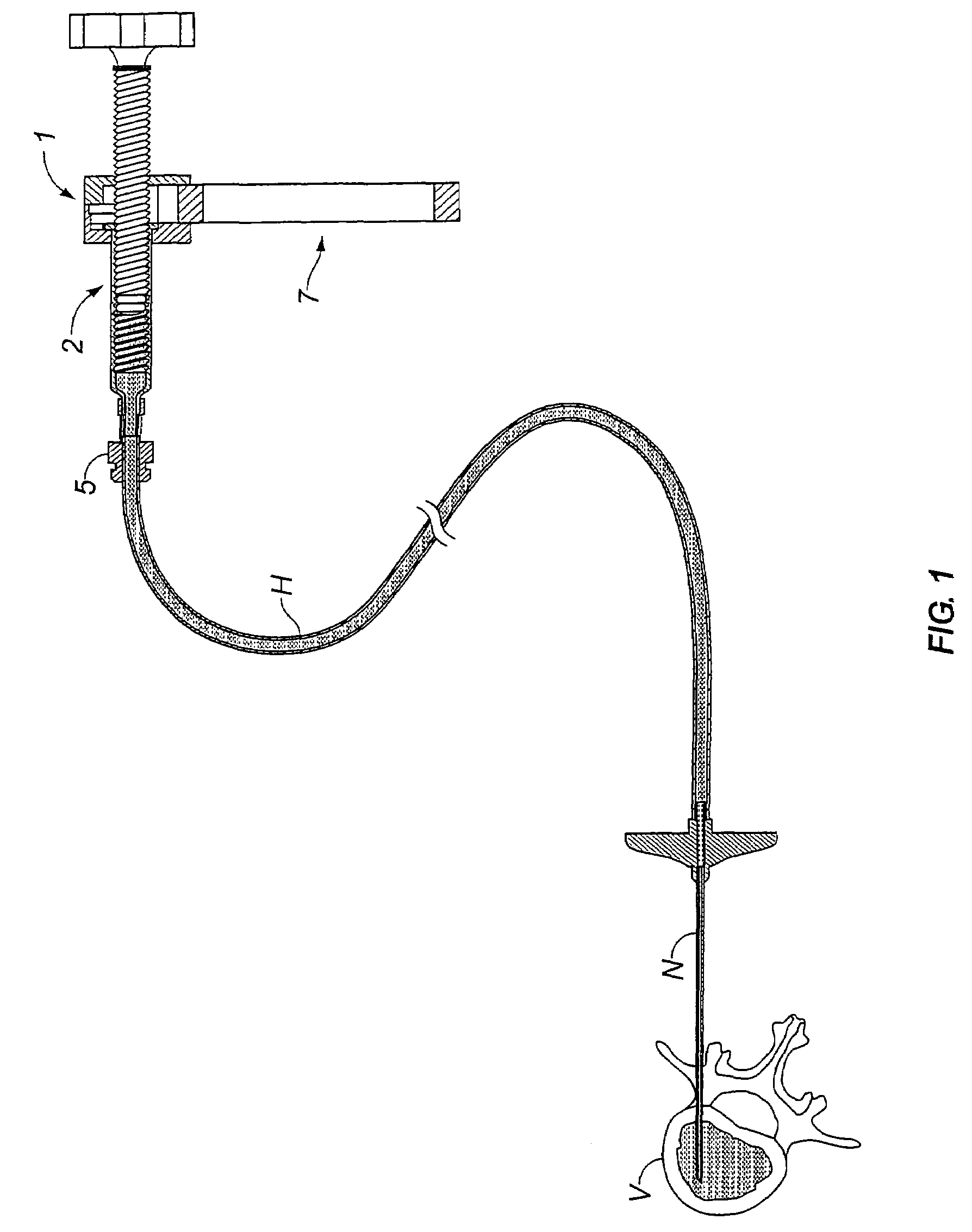 Device for the manual metering of a medical fluid, particularly bone cement