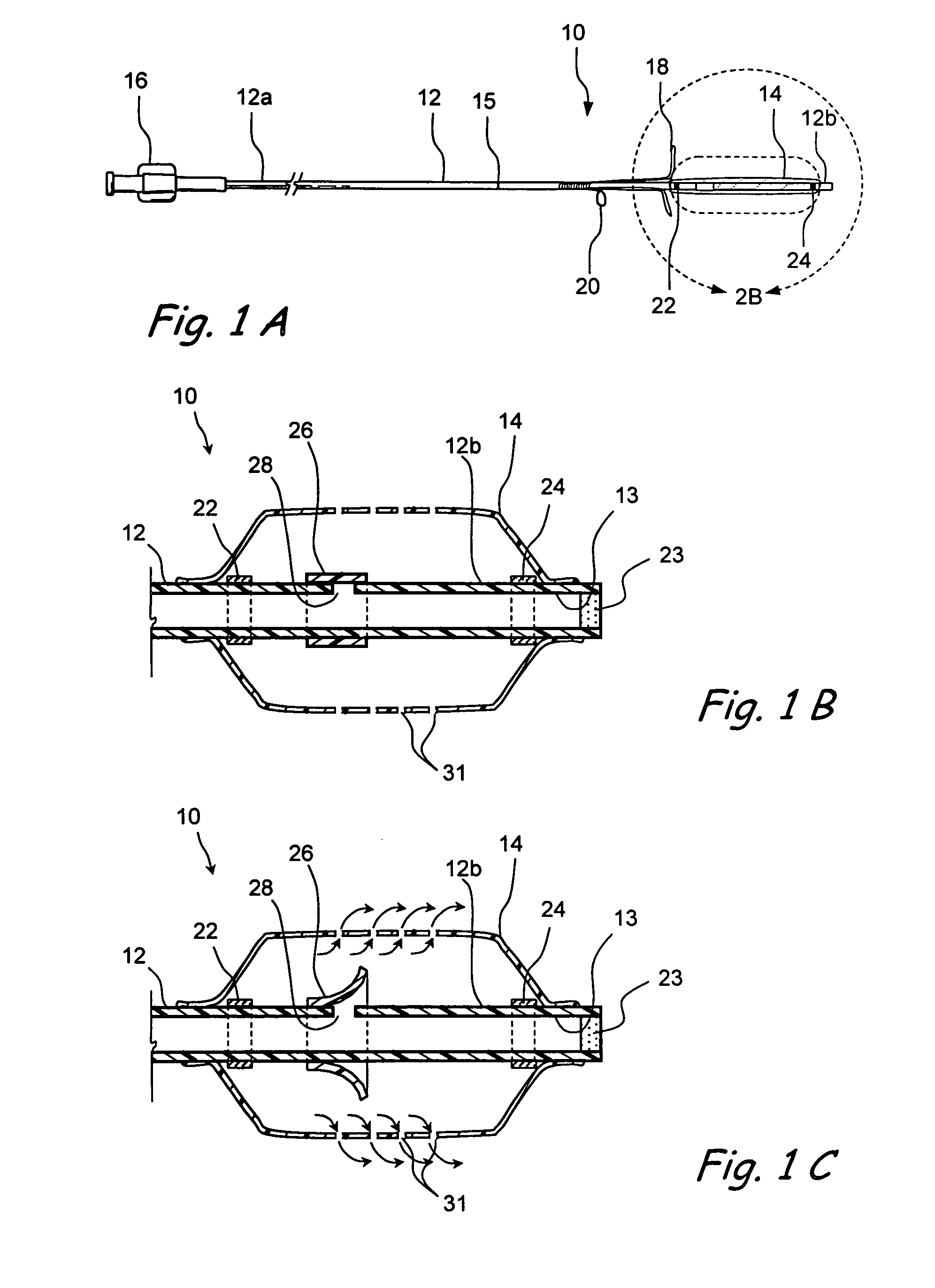 Implantable devices and methods for treating sinusitis and other disorders