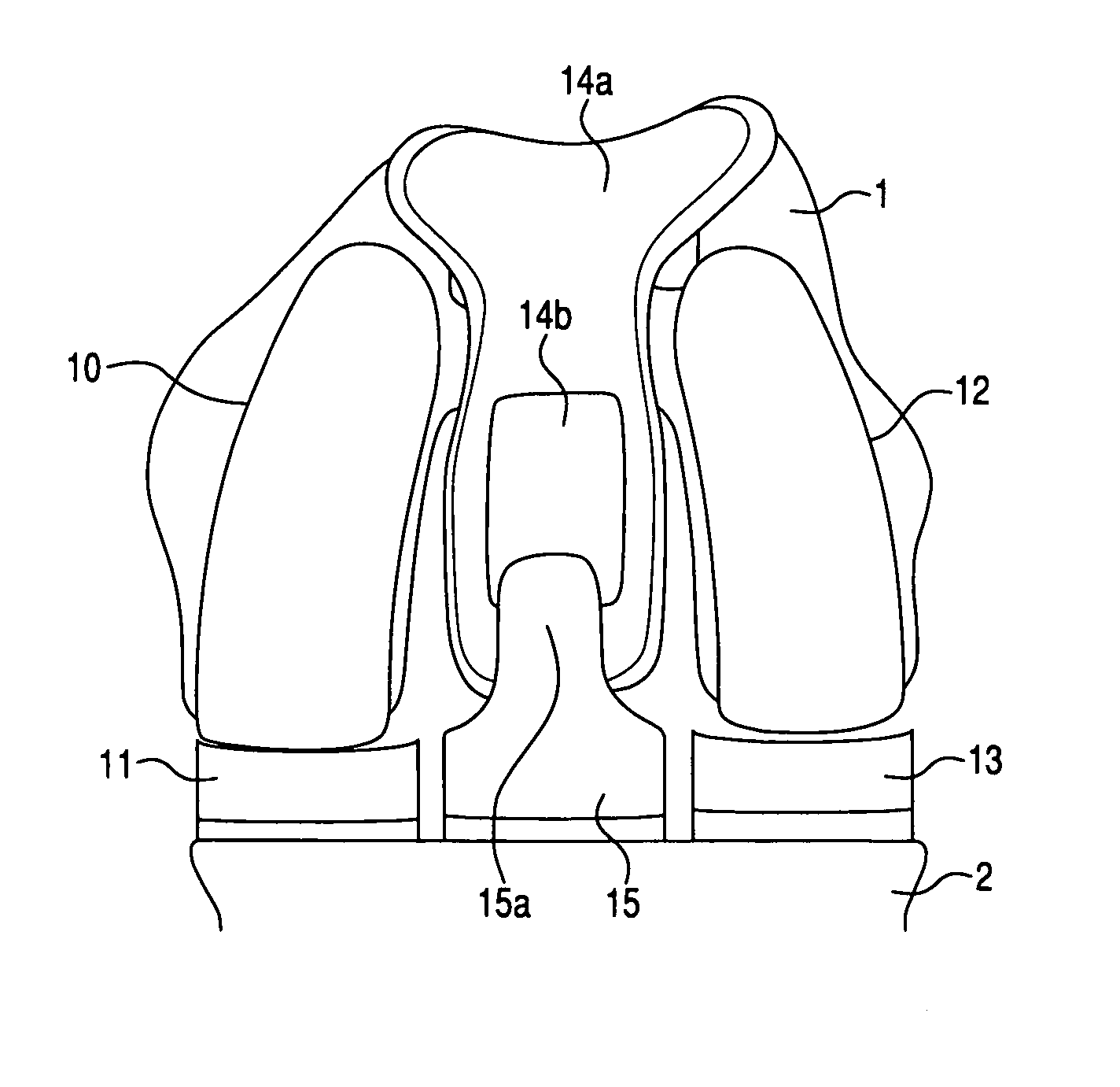 Multi-compartmental prosthetic device with patellar component transition