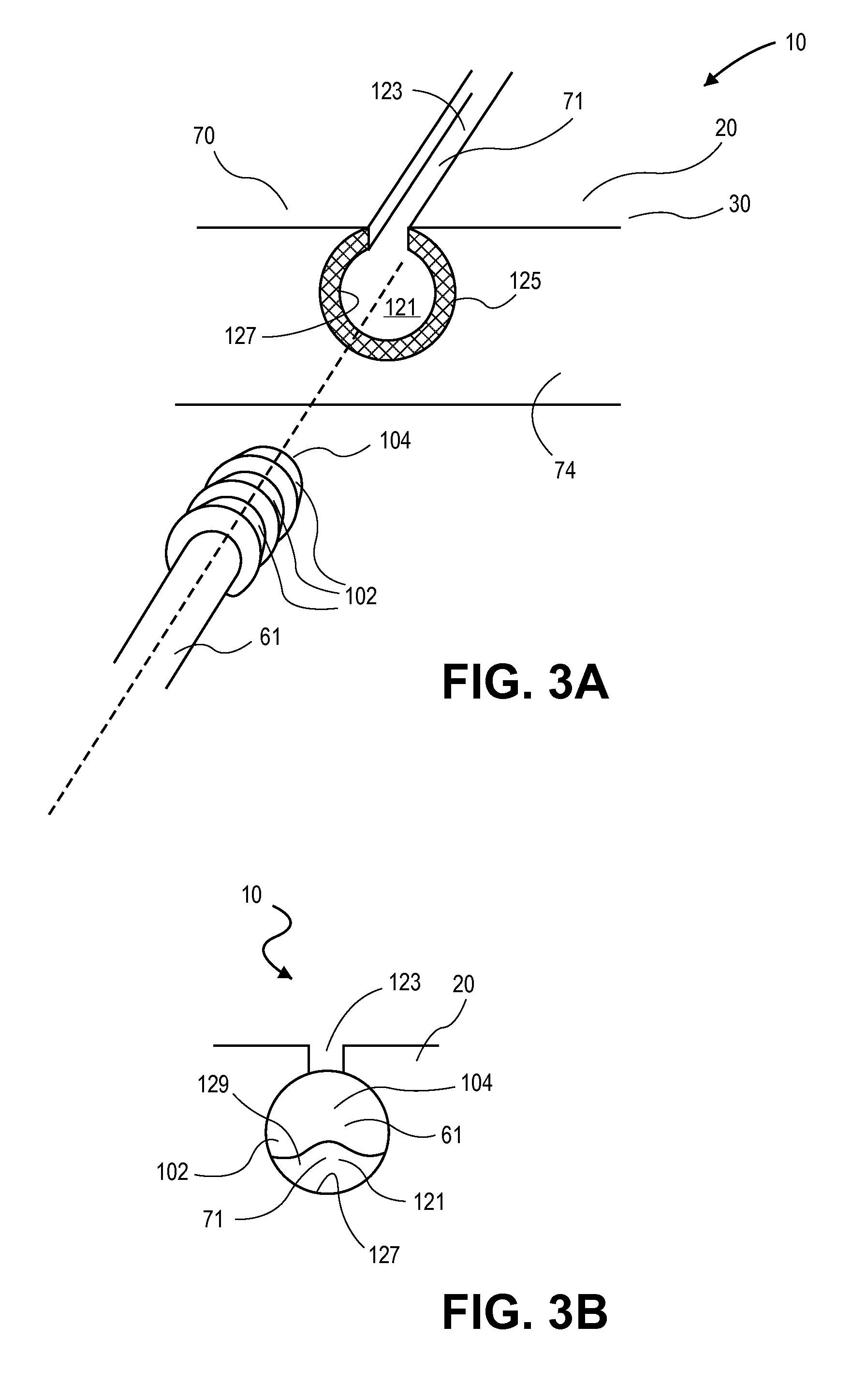 Mouthguard apparatus and related method