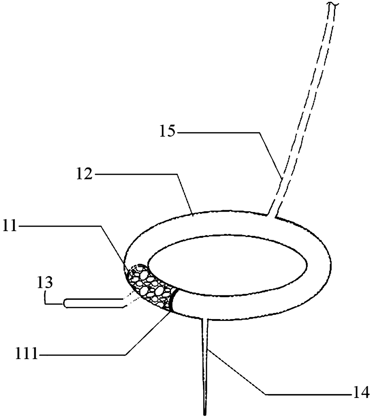 Device for treating gallstones and use method and application thereof