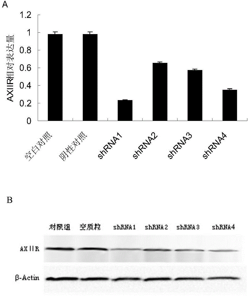 shRNA for inhibiting tumor cell growth as well as recombinant vector and application thereof