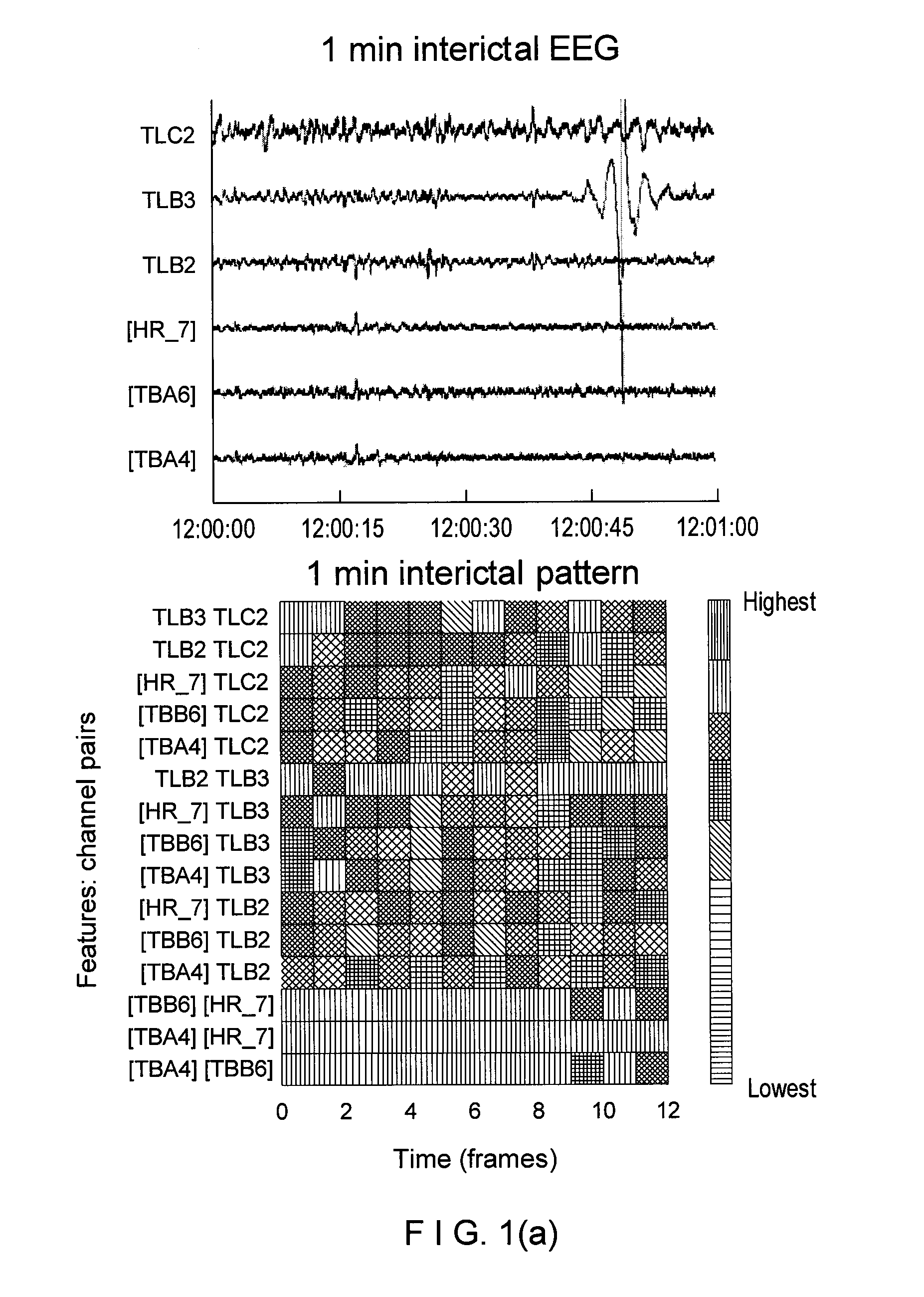 Method, system, and computer-accessible medium for classification of at least one ictal state
