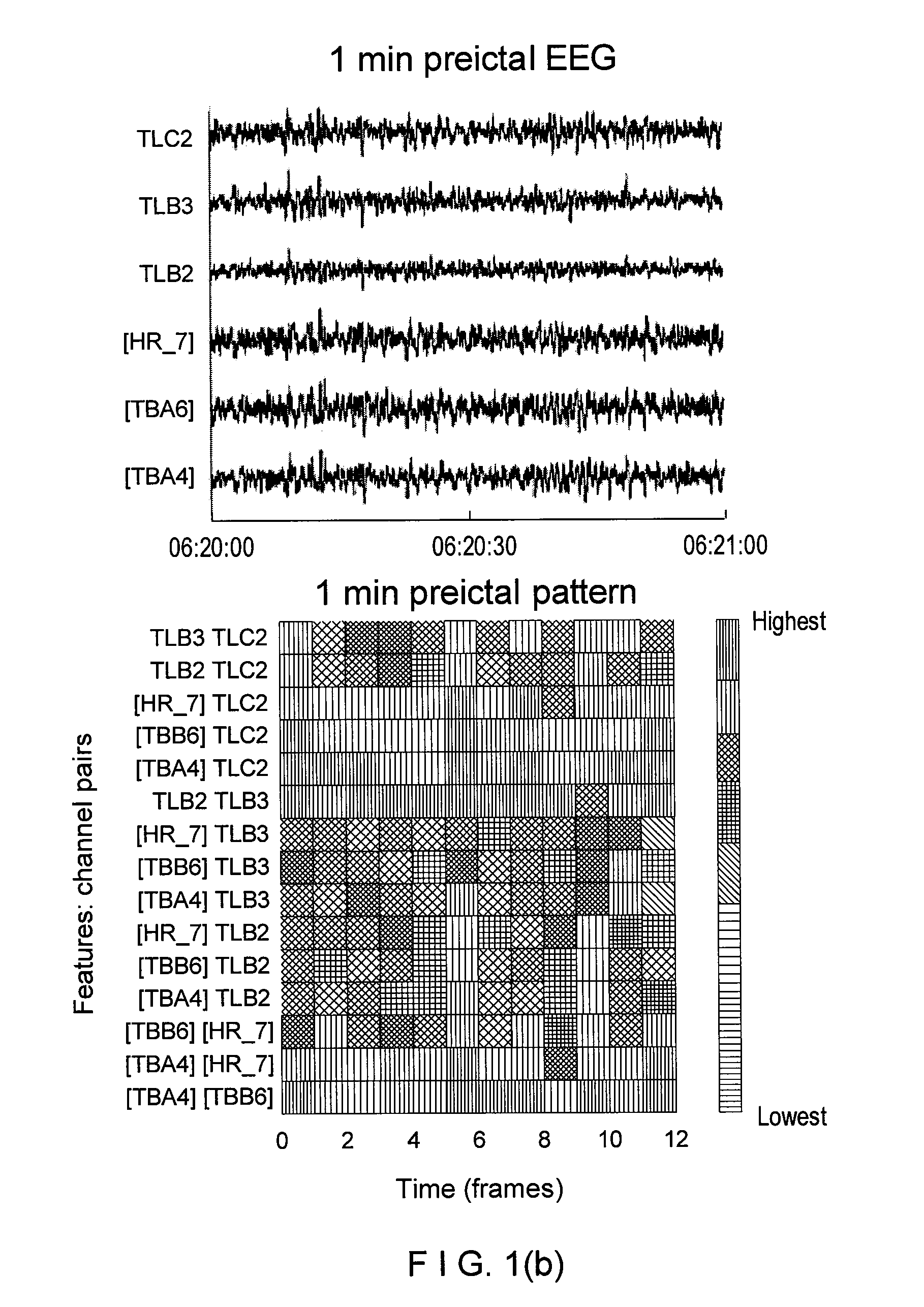 Method, system, and computer-accessible medium for classification of at least one ictal state