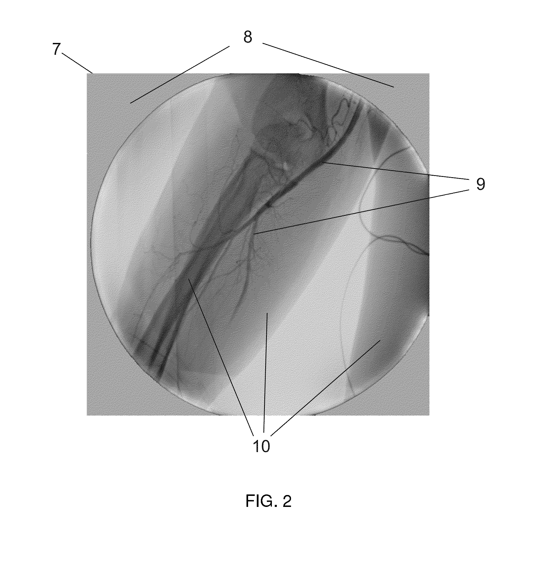 Method for acquisition of subtraction angiograms