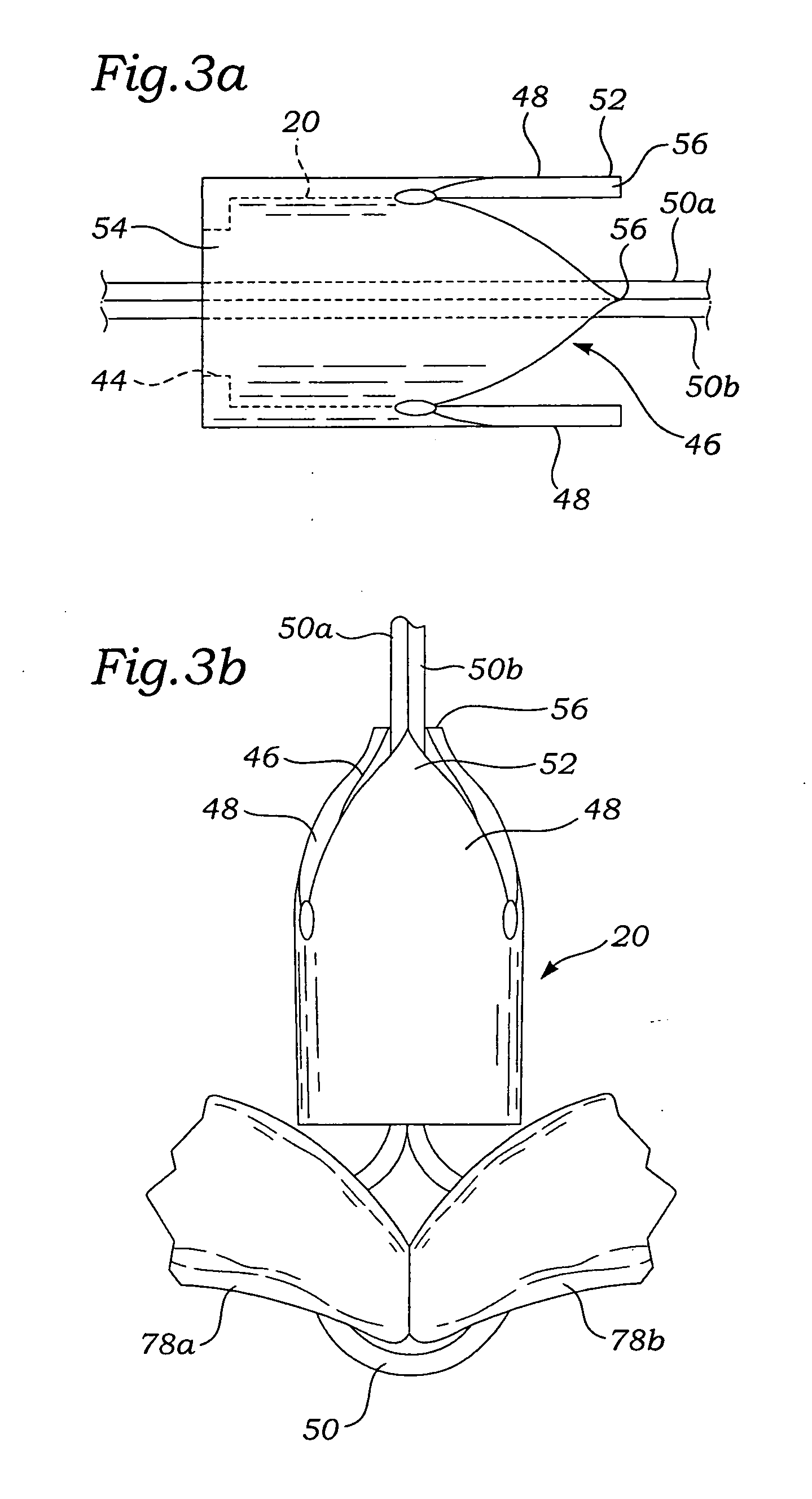 System, apparatus, and method for fastening tissue