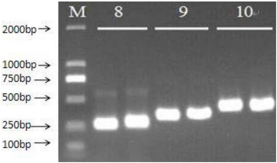 Method and primers for detecting dyskeratosis congenita (DC)-related gene WRAP 53