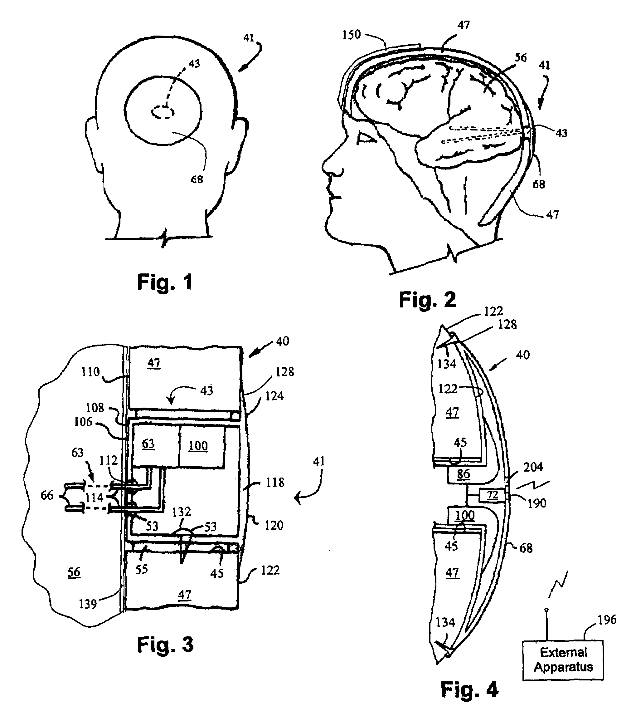 Cerebral or organ interface system