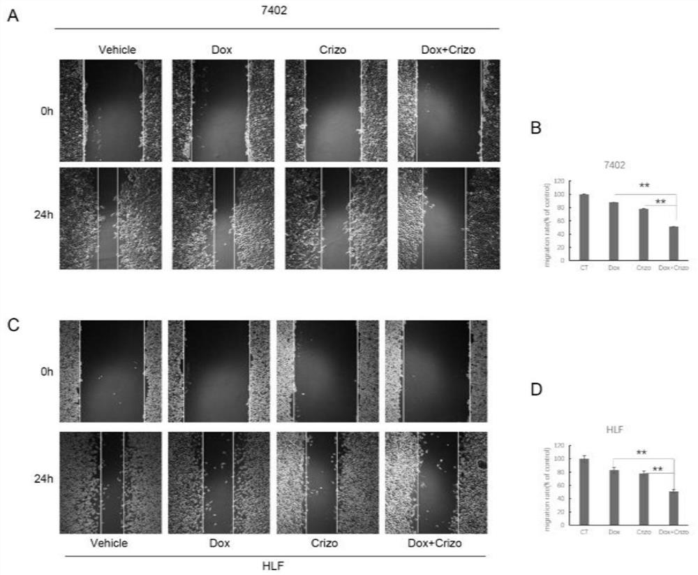 Composition for treating liver cancer and its application