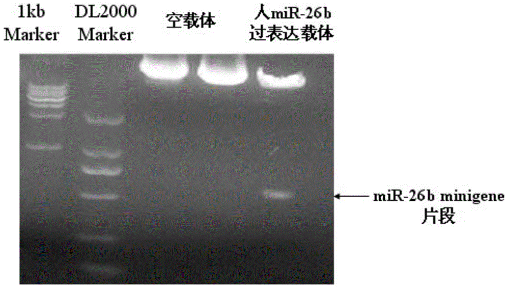 Application of human miR-26b in preparation of drugs for inhibiting fat cell proliferation