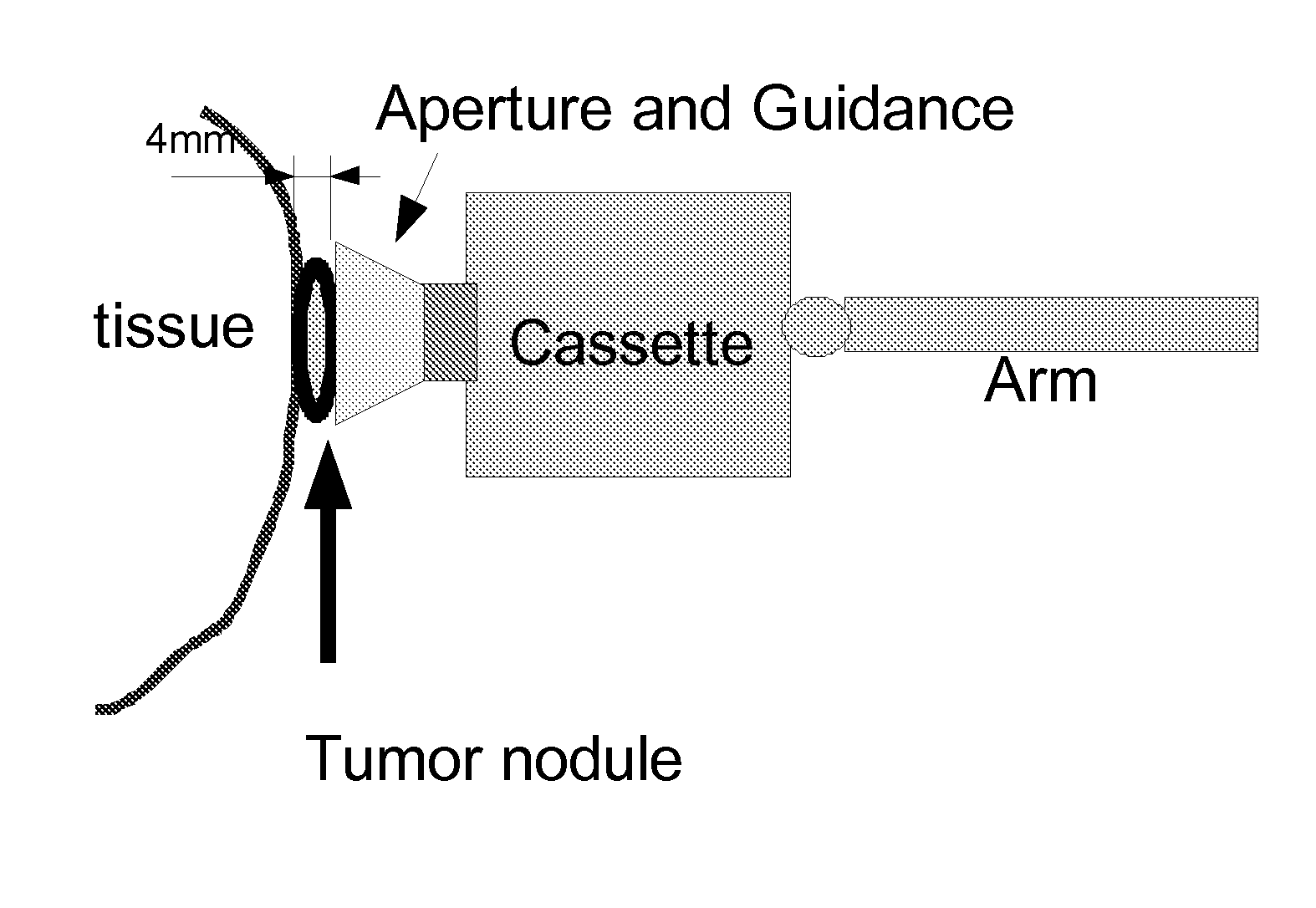 Direct visualization robotic intra-operative radiation therapy applicator device