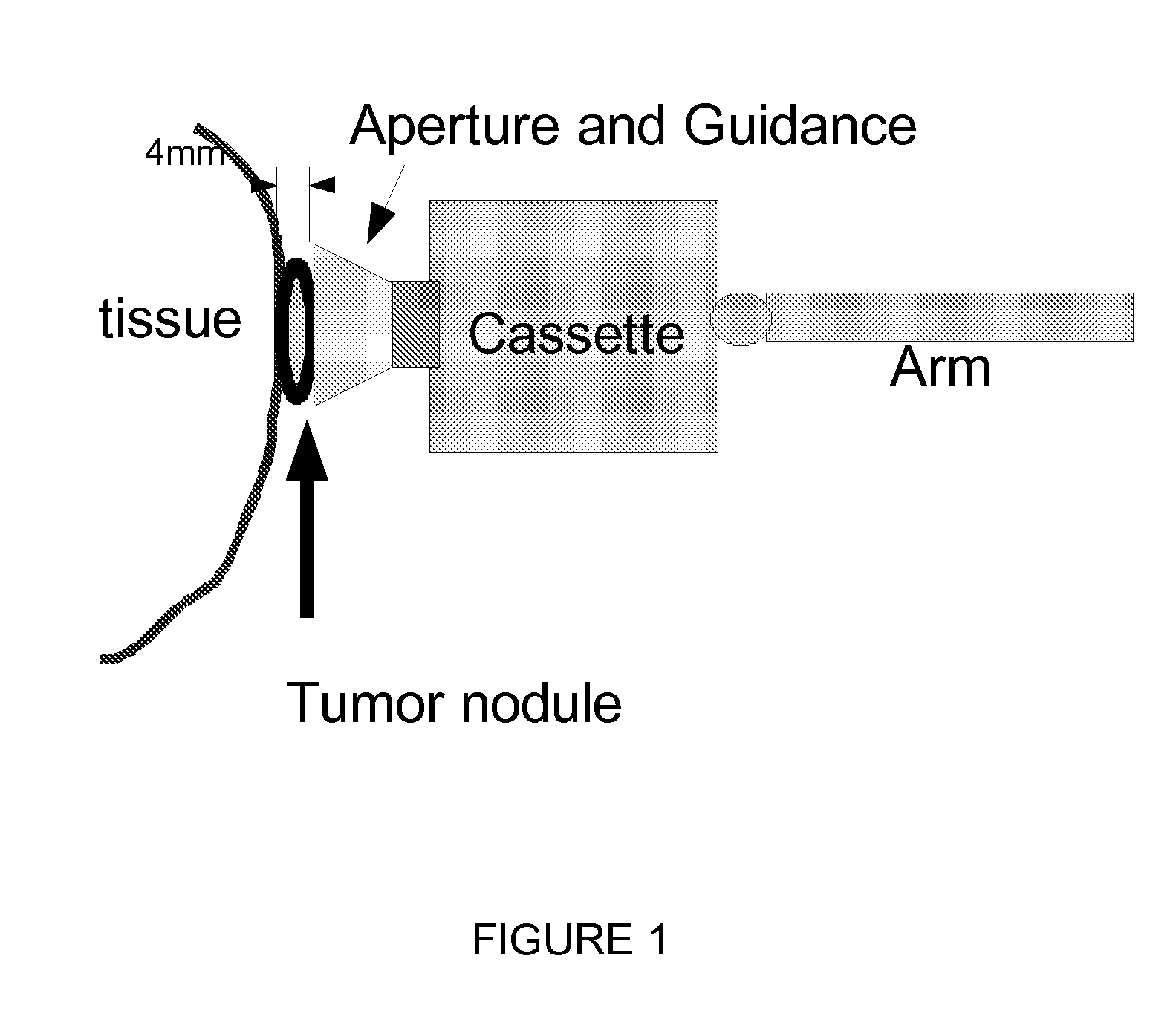 Direct visualization robotic intra-operative radiation therapy applicator device