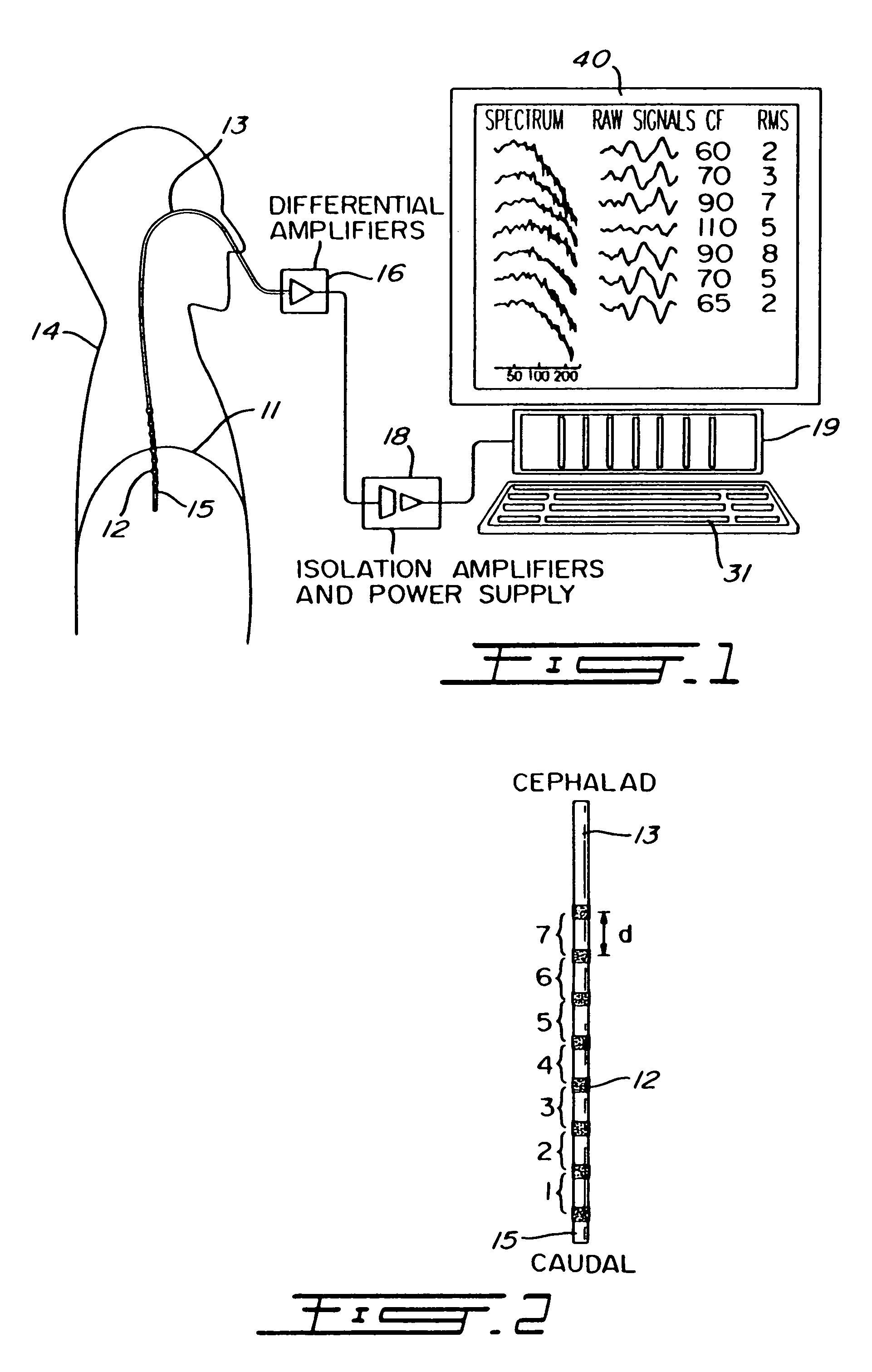 Target drive ventilation gain controller and method