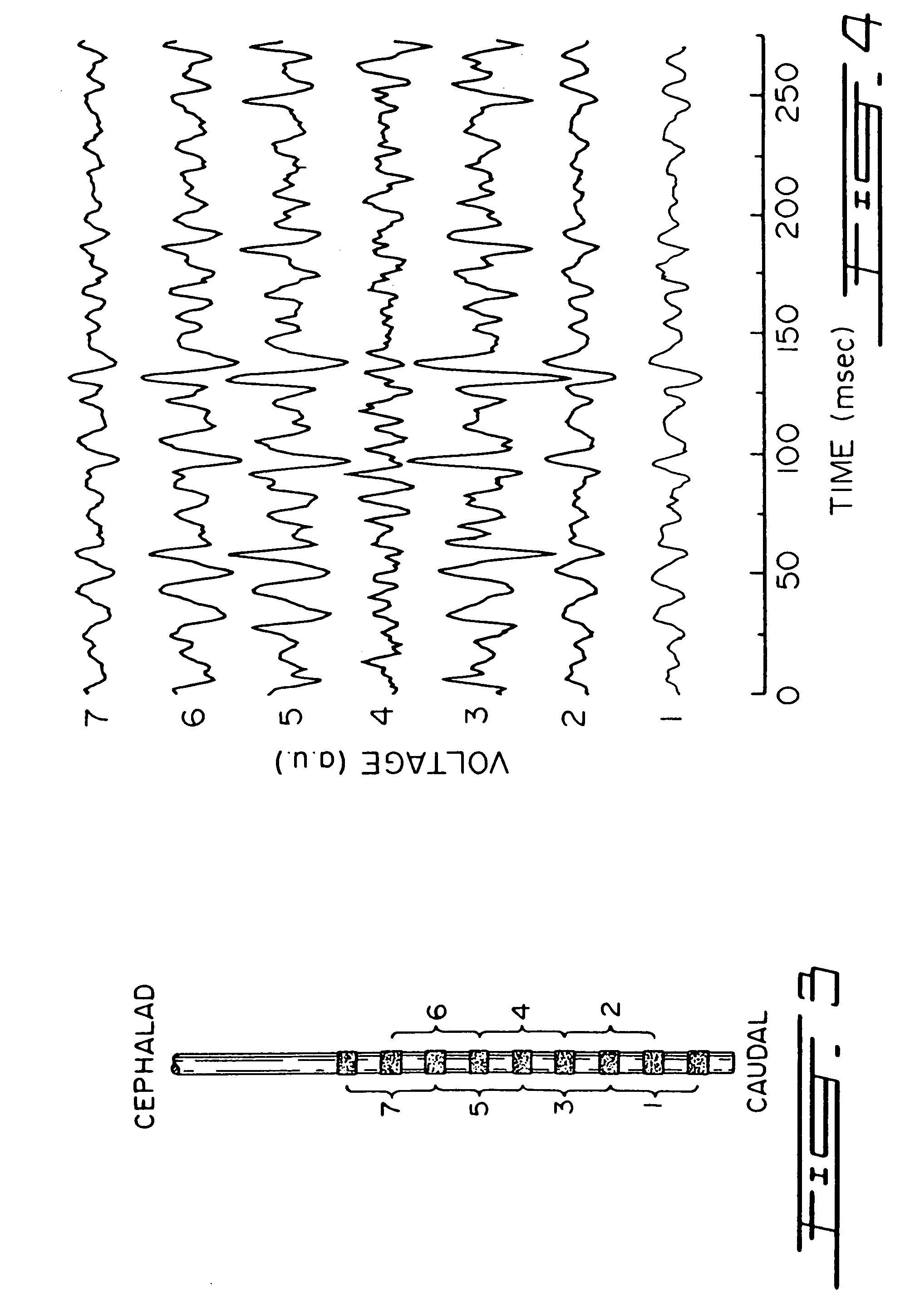 Target drive ventilation gain controller and method