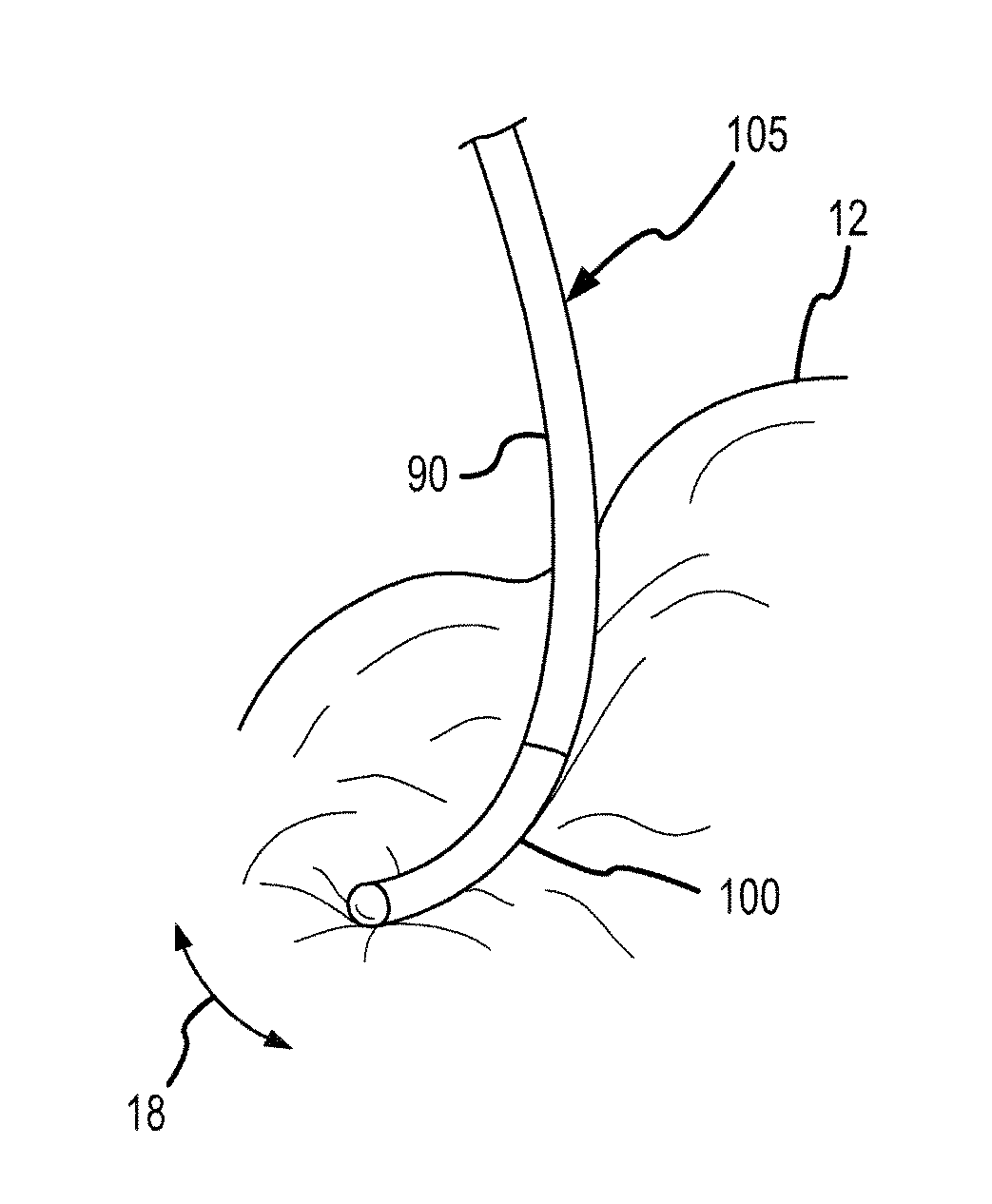 Flexible conductive polymer electrode and method for ablation