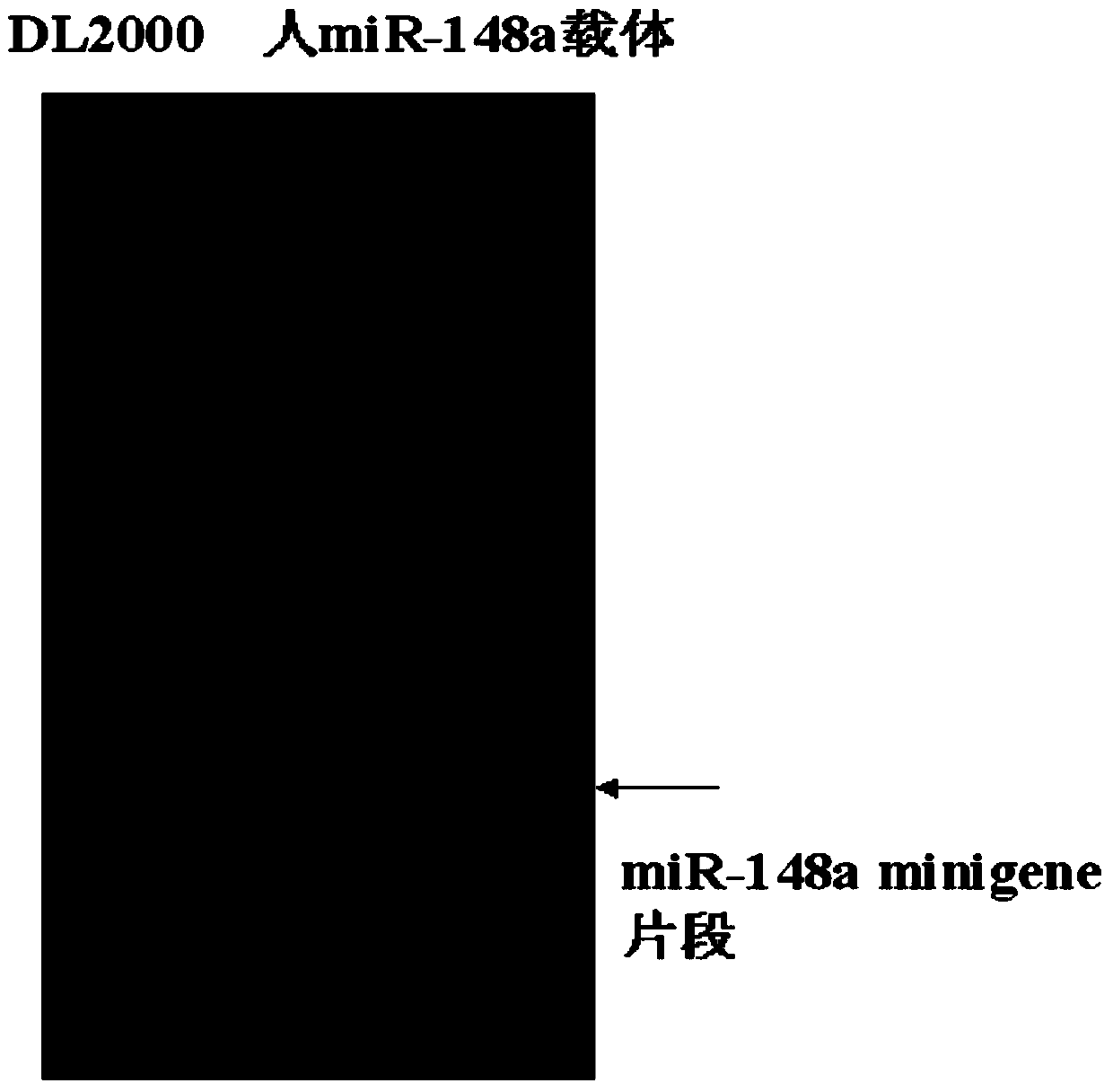 Application of human miR-148a to preparation of medicine for improving adipose cell insulin sensitivity