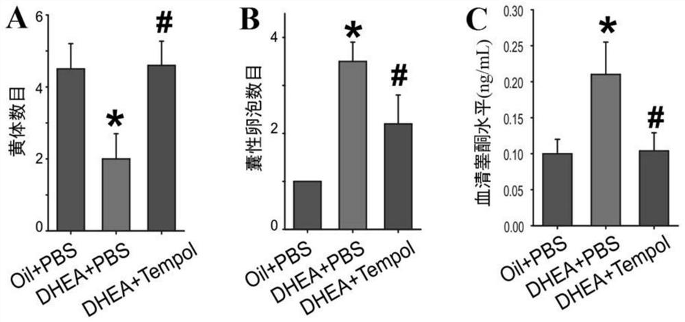 Application of tempol in the preparation of drugs for the treatment of polycystic ovary syndrome