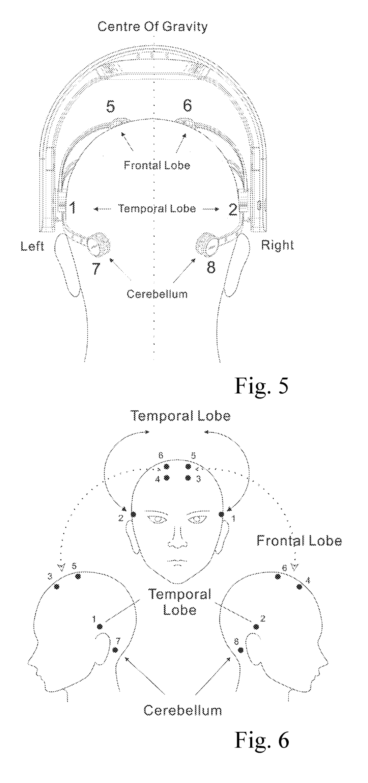 Portable Composite Waveform Transcranial Electrical Stimulation System