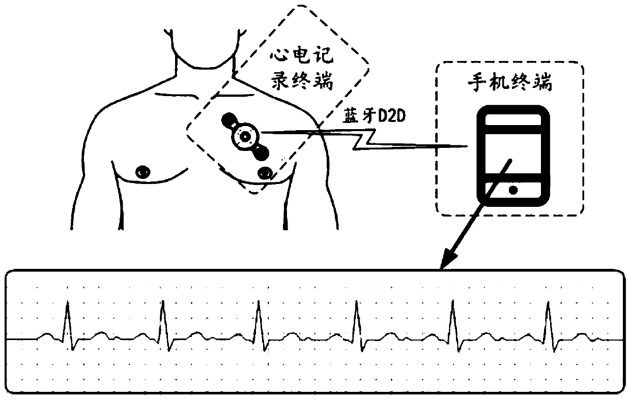 Intelligent dynamic electrocardiogram system and working method thereof