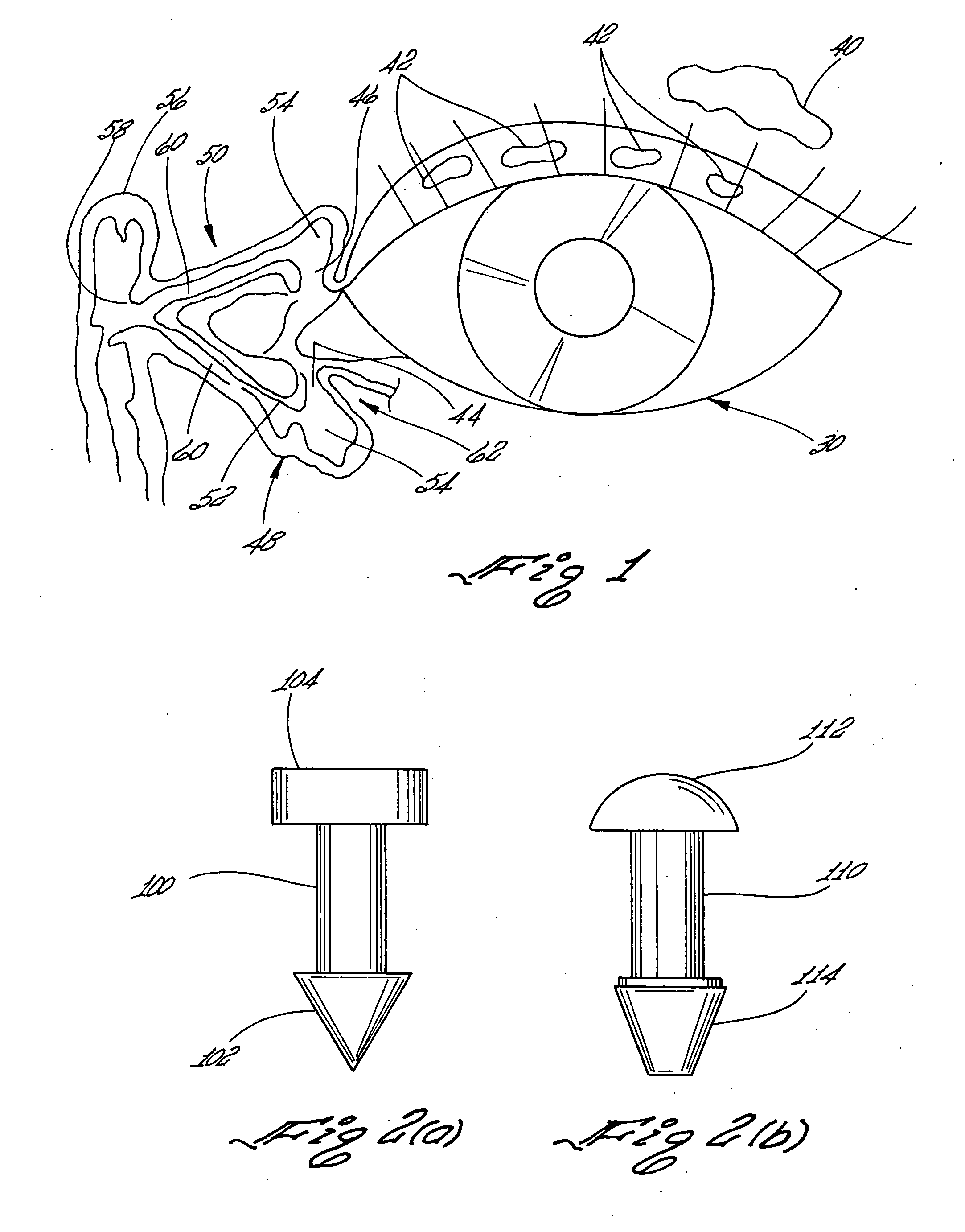 Implant capable of forming a differential image in an eye and methods of inserting and locating same