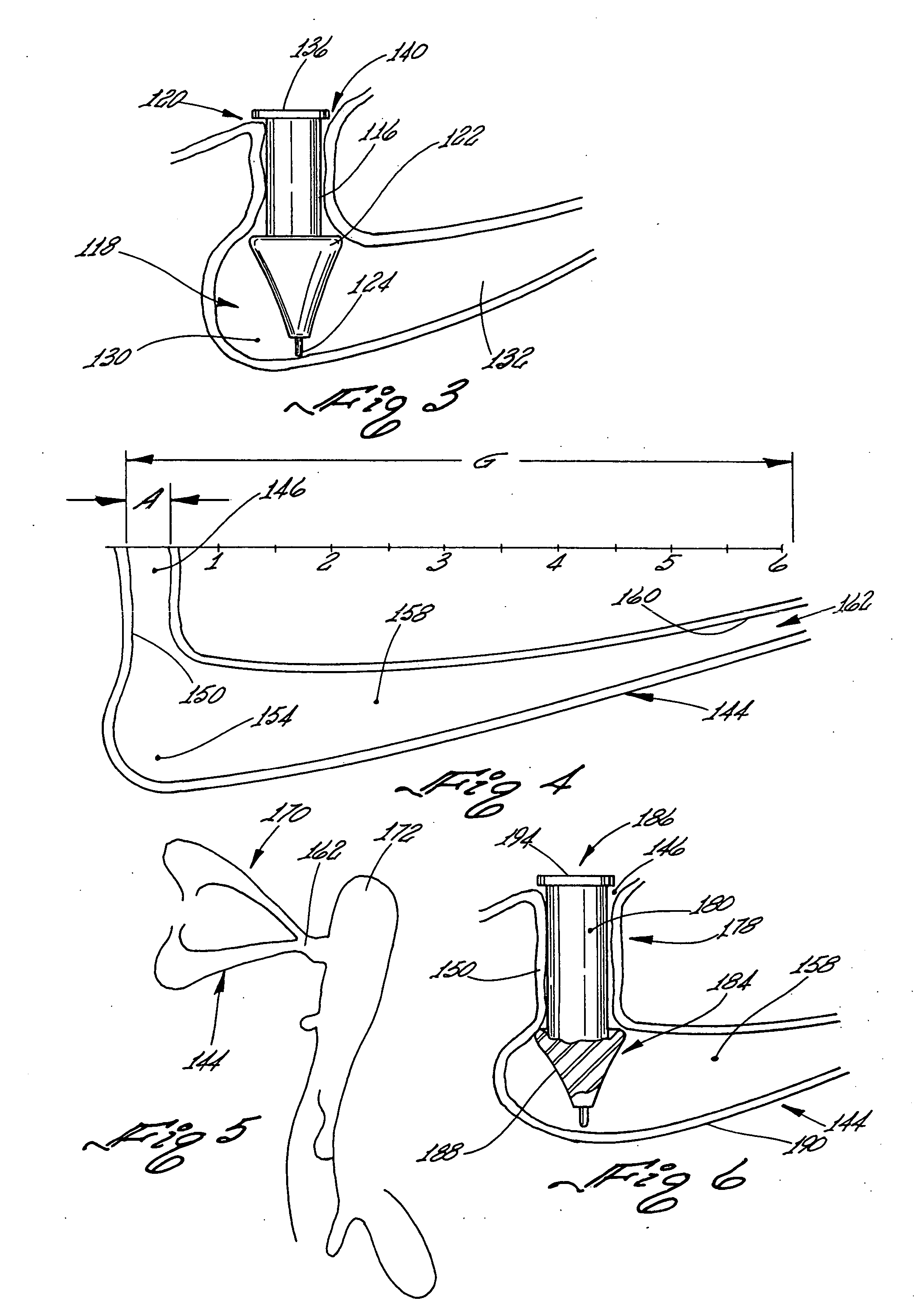 Implant capable of forming a differential image in an eye and methods of inserting and locating same