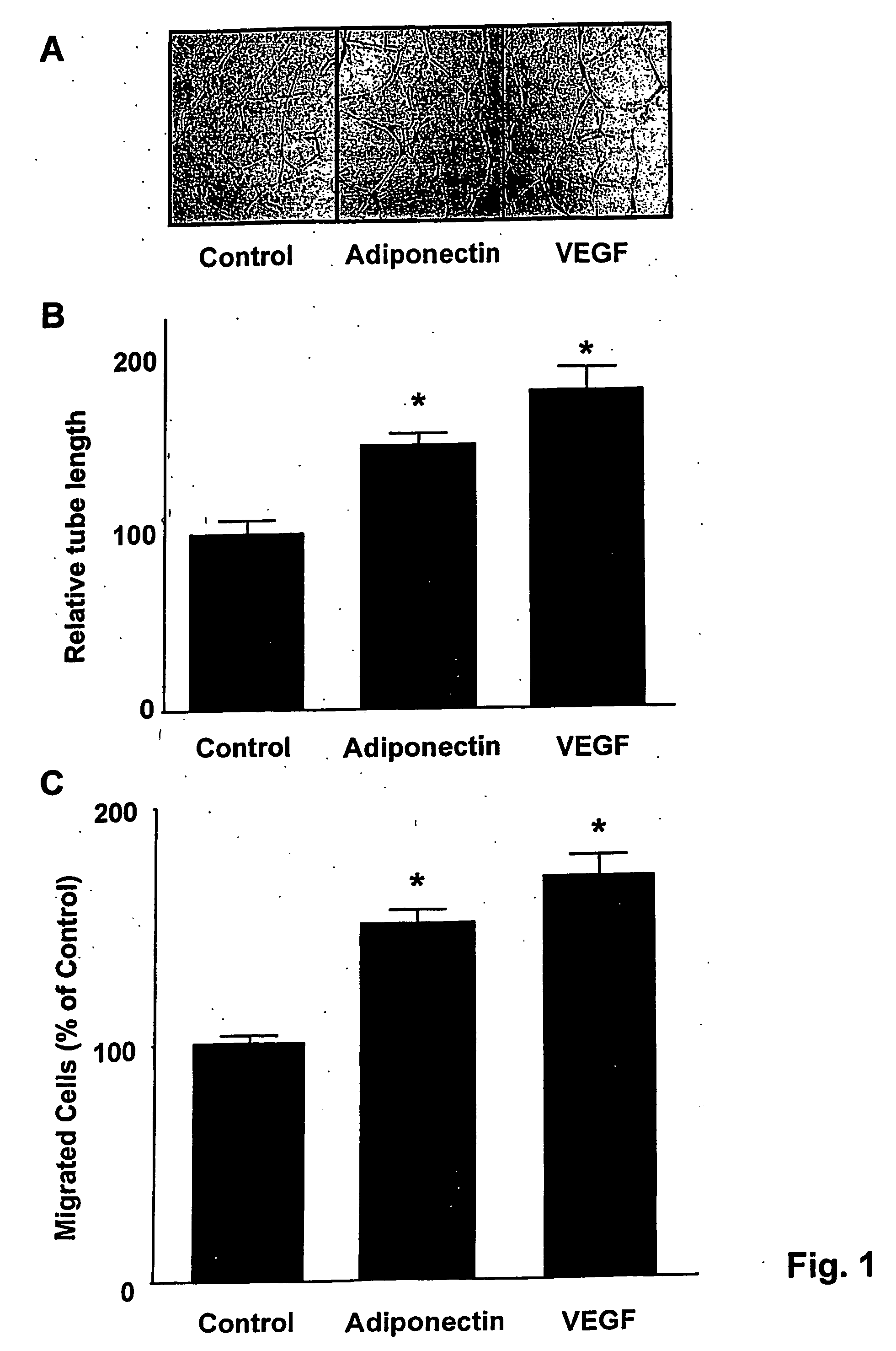 Methods And Compositions Using Adiponectin For Treatment Of Cardiac Disorders And For Stimulation Of Angiogenesis