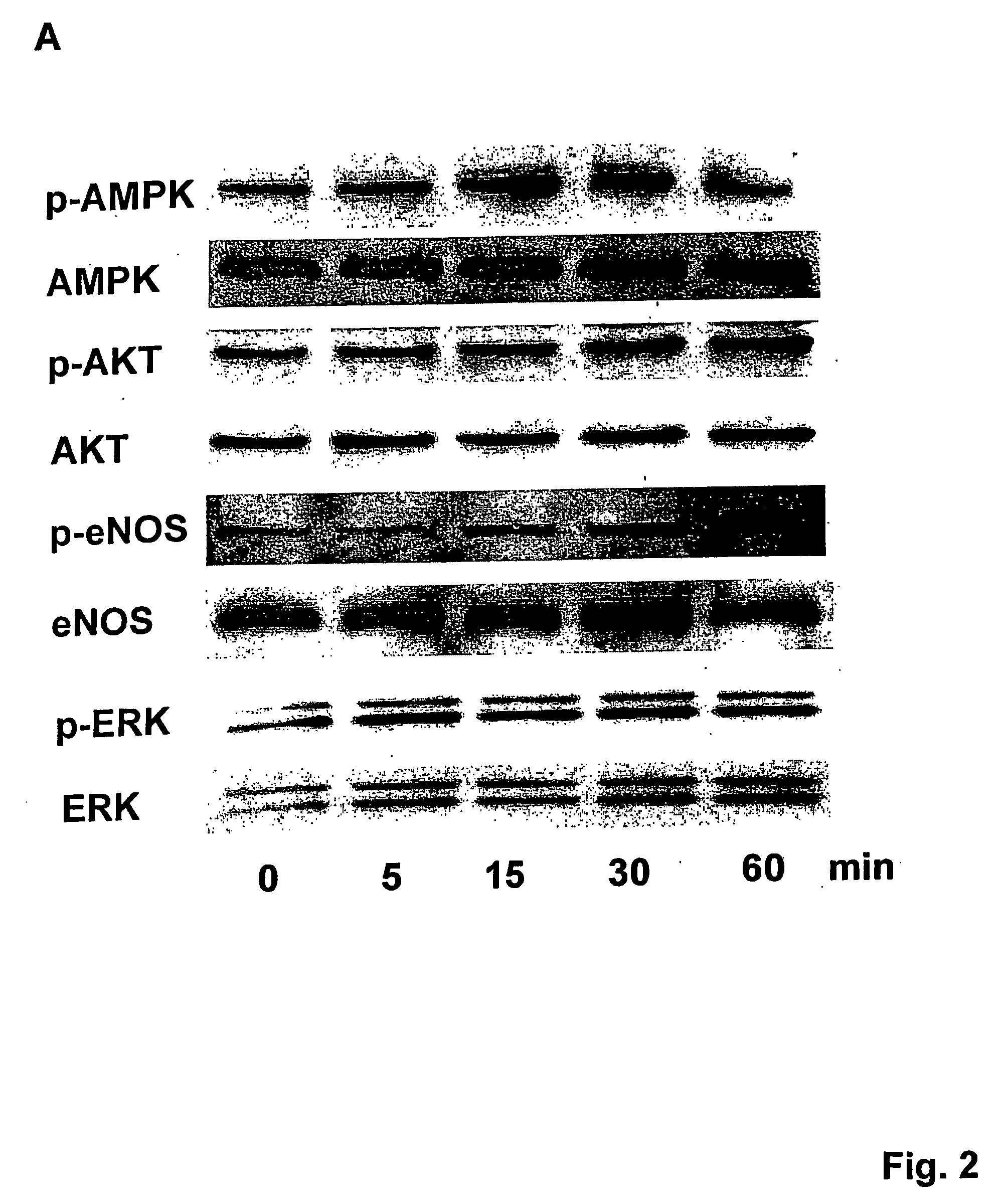 Methods And Compositions Using Adiponectin For Treatment Of Cardiac Disorders And For Stimulation Of Angiogenesis