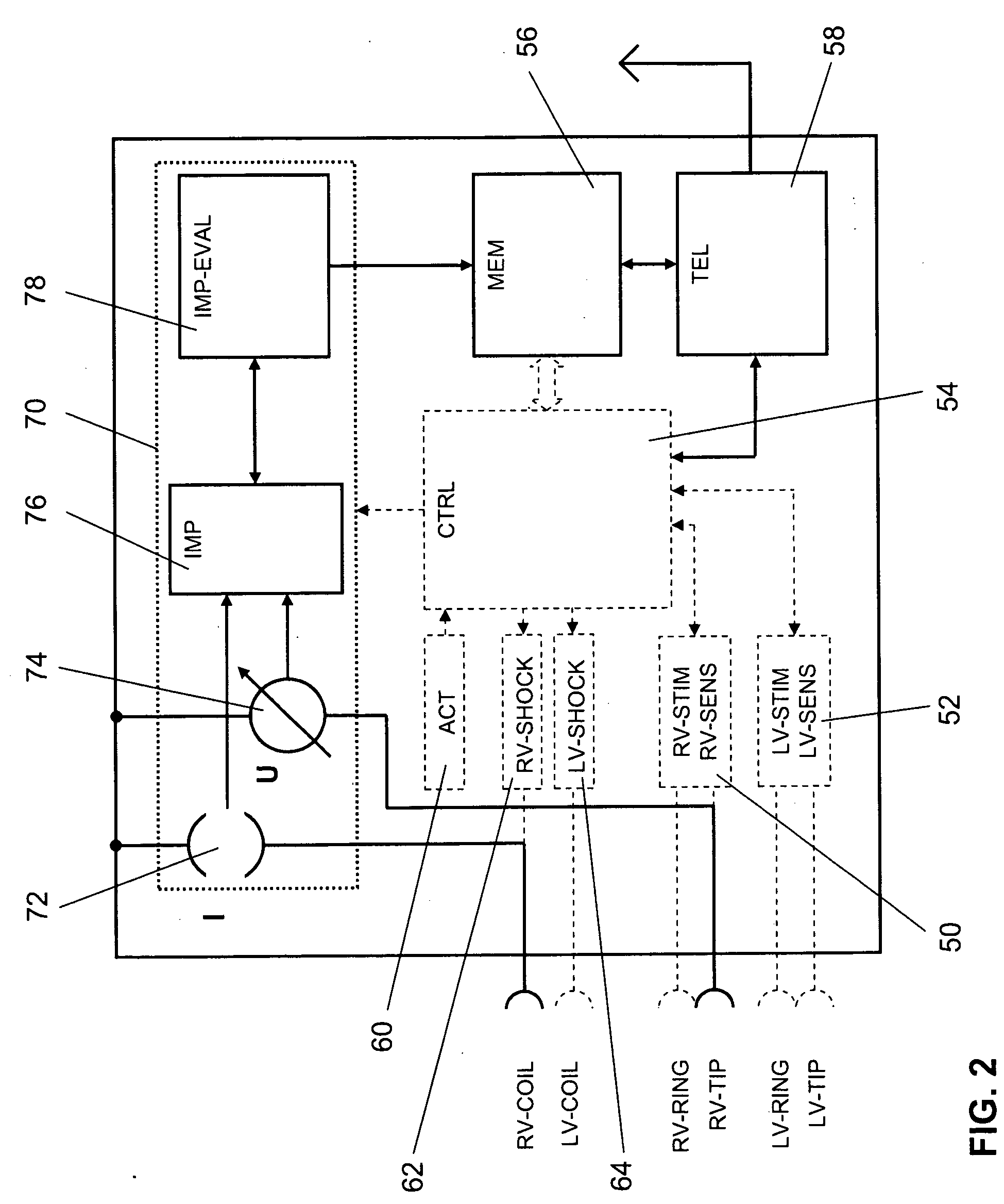 System and method for analyzing an impedance course