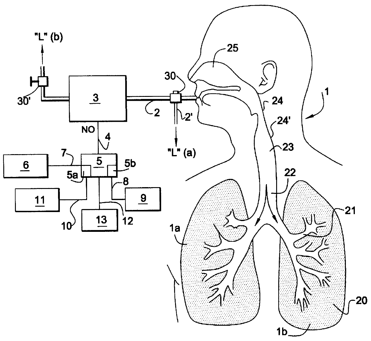 Device for determining the levels of NO in exhaled air