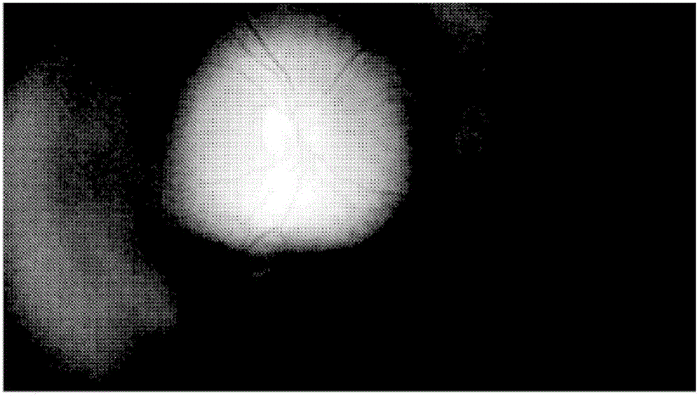 Wide field retinal image capture system and method