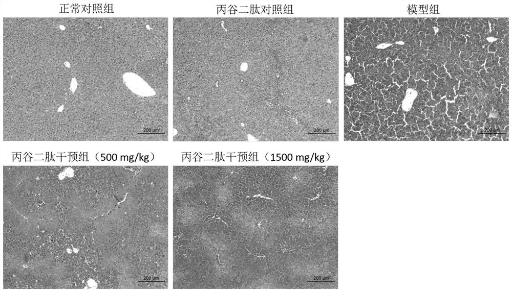 Application of CG dipeptide in the preparation of drugs for the prevention and treatment of acute liver failure