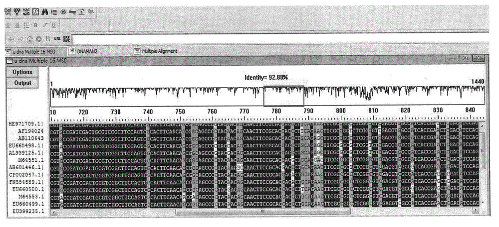 Xylanase gene derived from streptomyces chartreusis and xylanase thereof