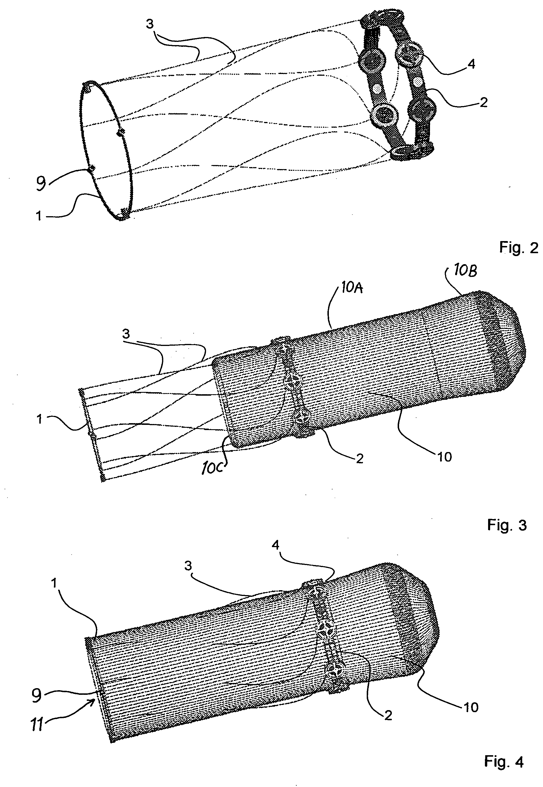 Apparatus with helical tension cables for ejecting a spin-stabilized body from a spacecraft