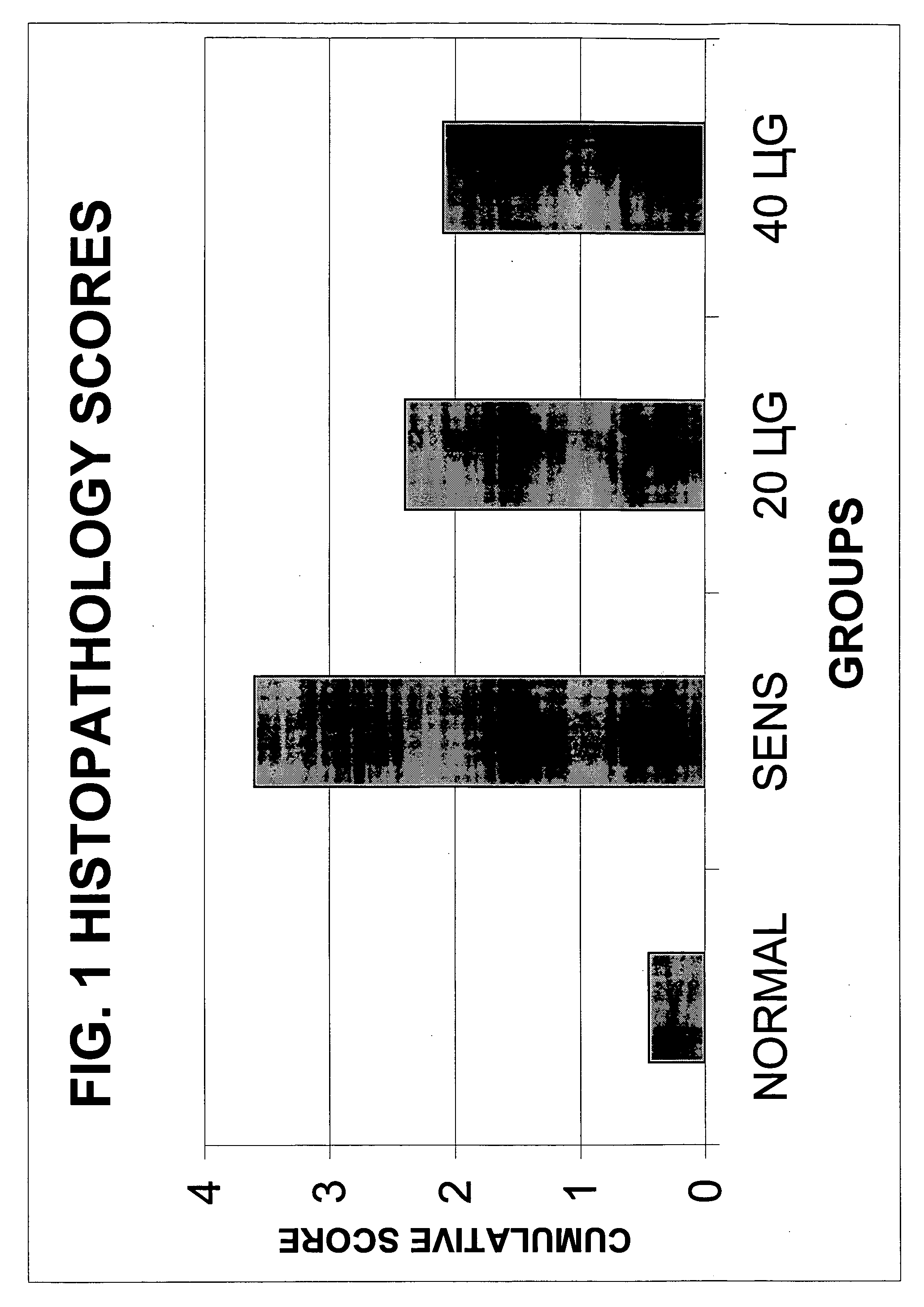 Sterically stabilized liposome and triamcinolone composition for treating the respiratory tract of a mammal