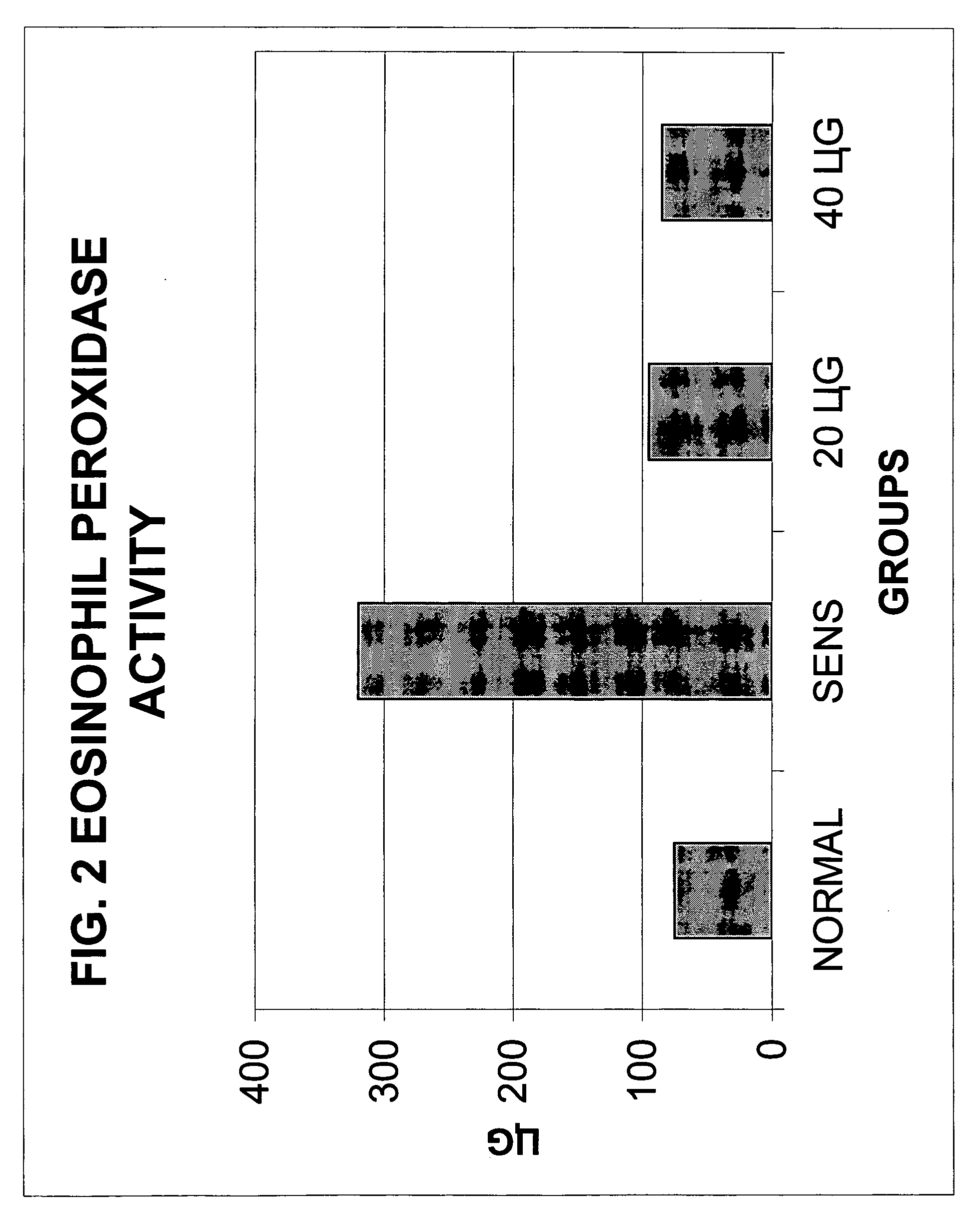 Sterically stabilized liposome and triamcinolone composition for treating the respiratory tract of a mammal