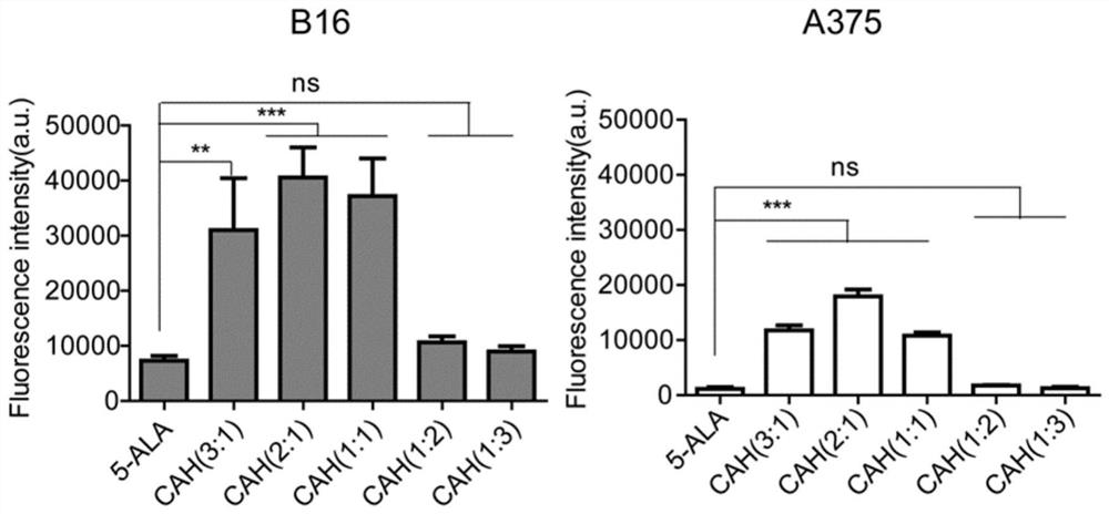 A nano drug delivery system loaded with 5-aminolevulinic acid and its preparation method and application