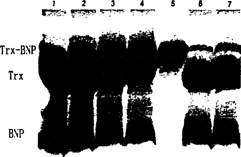 Enterpeptidase light chain variant with high activity and high stability