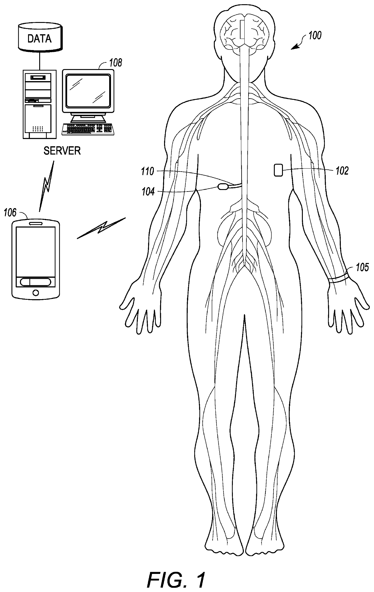 Emergency management implantable drug delivery systems