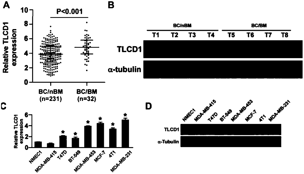 Application of TLCD1 to diagnosis, prognosis and treatment of BC (breast cancer) metastasis
