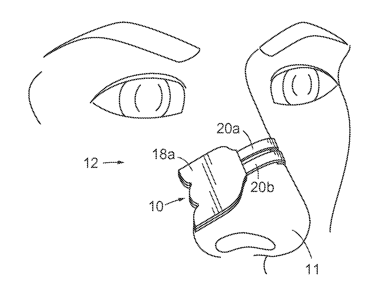 Economical Nasal Dilator and Method of Manufacture