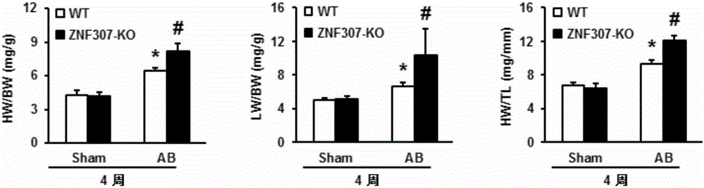 Application of zinc finger protein 307 (ZNF307) in treating myocardial hypertrophy
