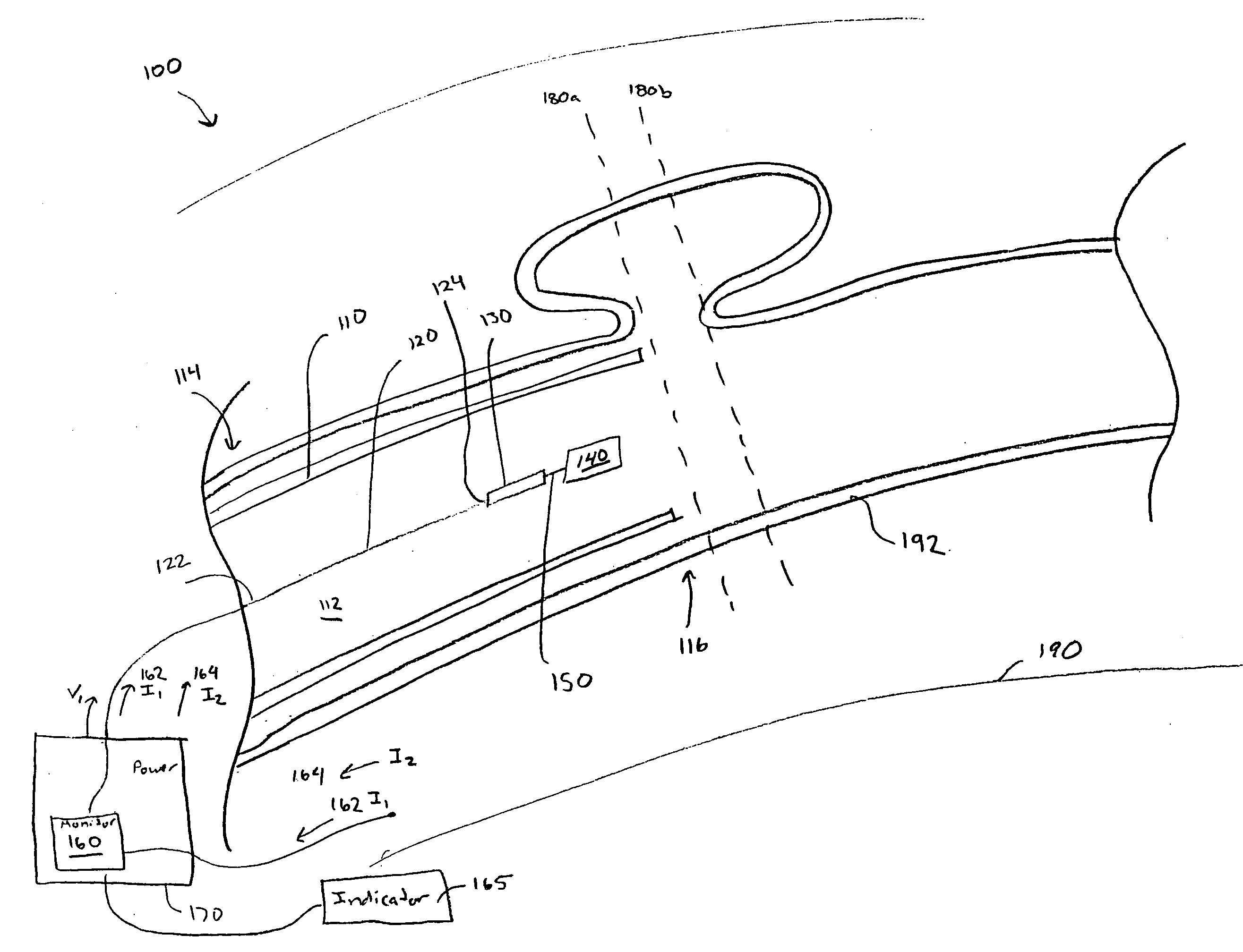 System and method for electrically determining position and detachment of an implantable device