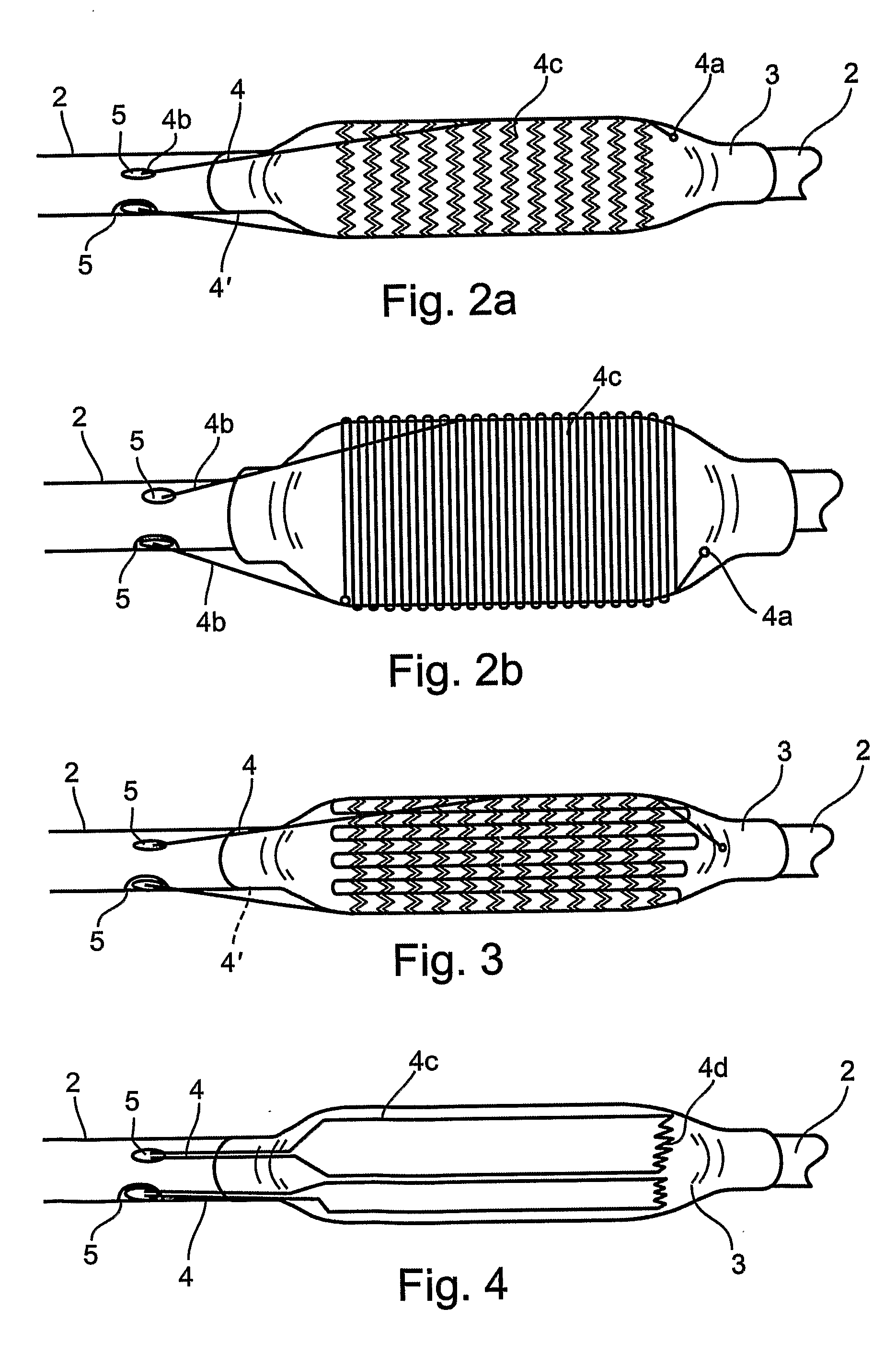 Apparatus and Method for Removing Deposits from Tubular Structure, Particularly Atheroma from Blood Vessels
