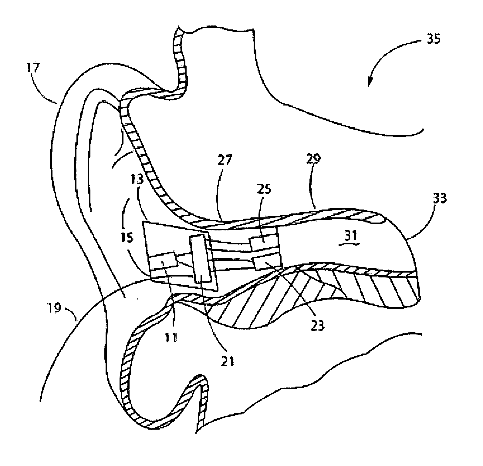 Ear input sound pressure level monitoring system