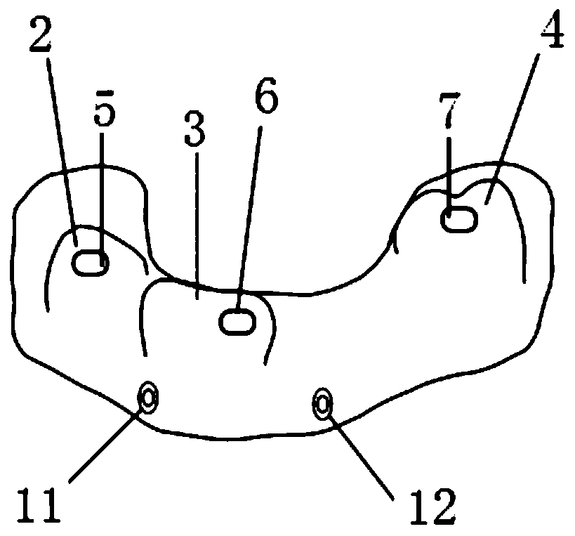 Dental trinity composite guide plate with precise positioning capability and manufacturing method