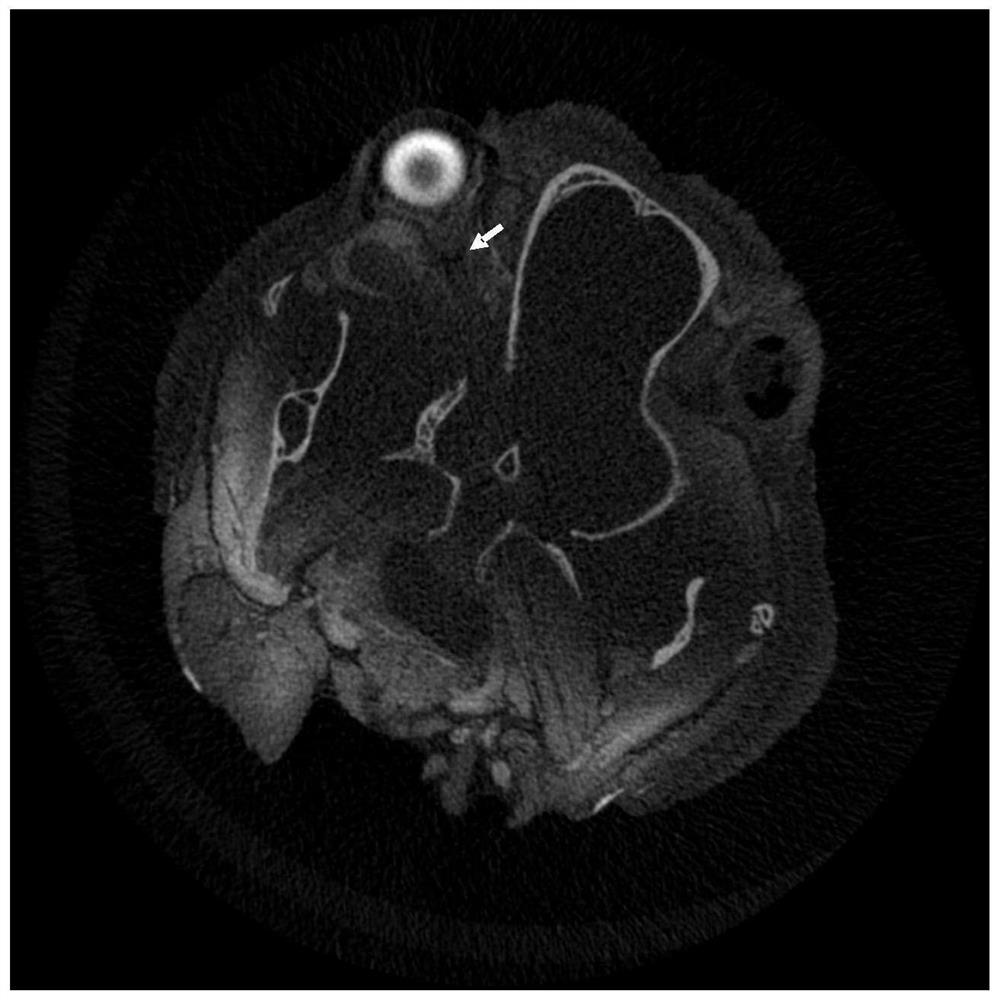 Method for modeling mouse far-end optic nerve injury model through skull positioning puncture