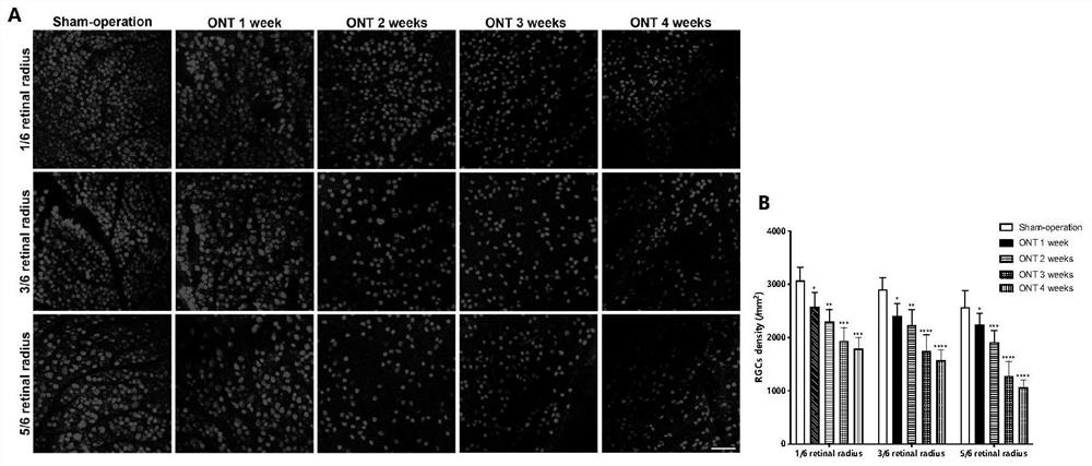 Method for modeling mouse far-end optic nerve injury model through skull positioning puncture